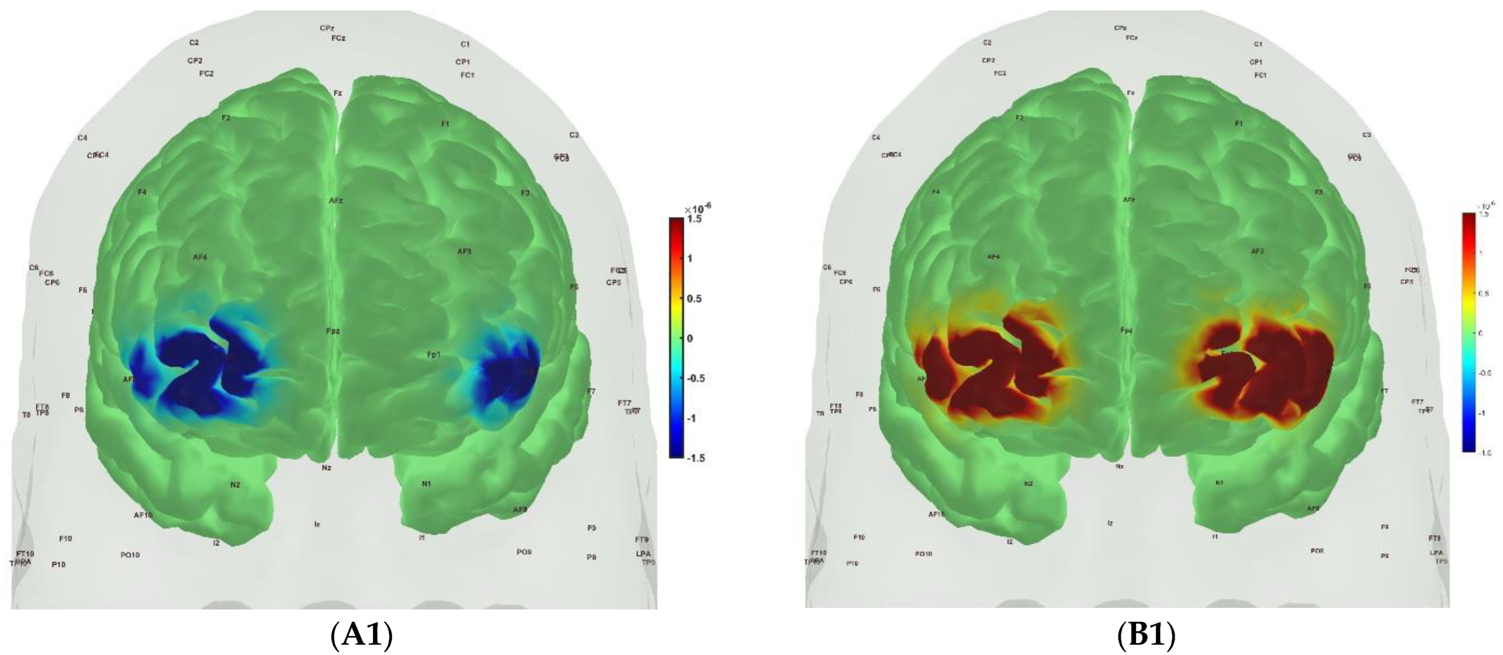 Brainsci 13 01099 g007a Brainsci 13 01099 g007a