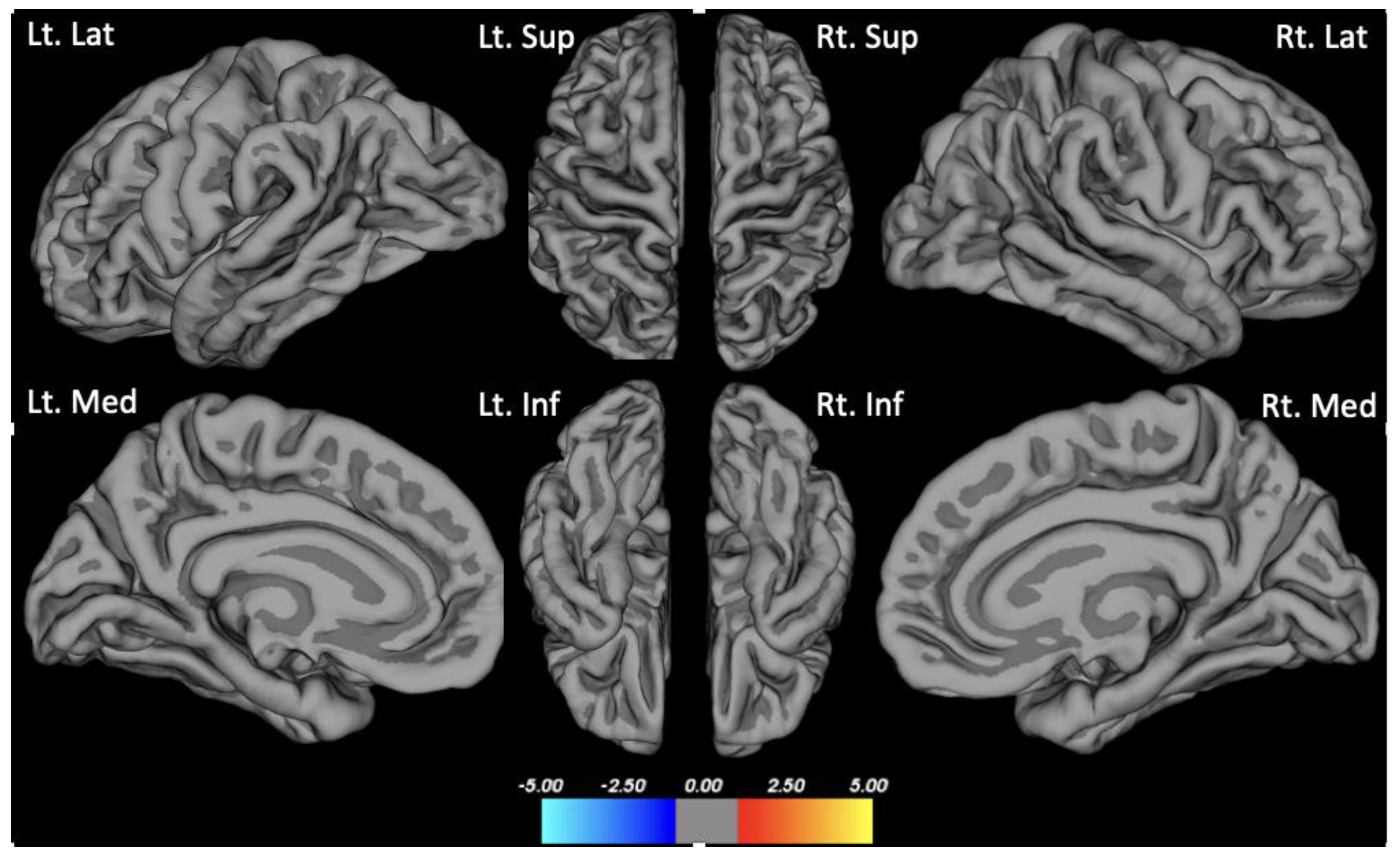 Brainsci 13 01111 g001