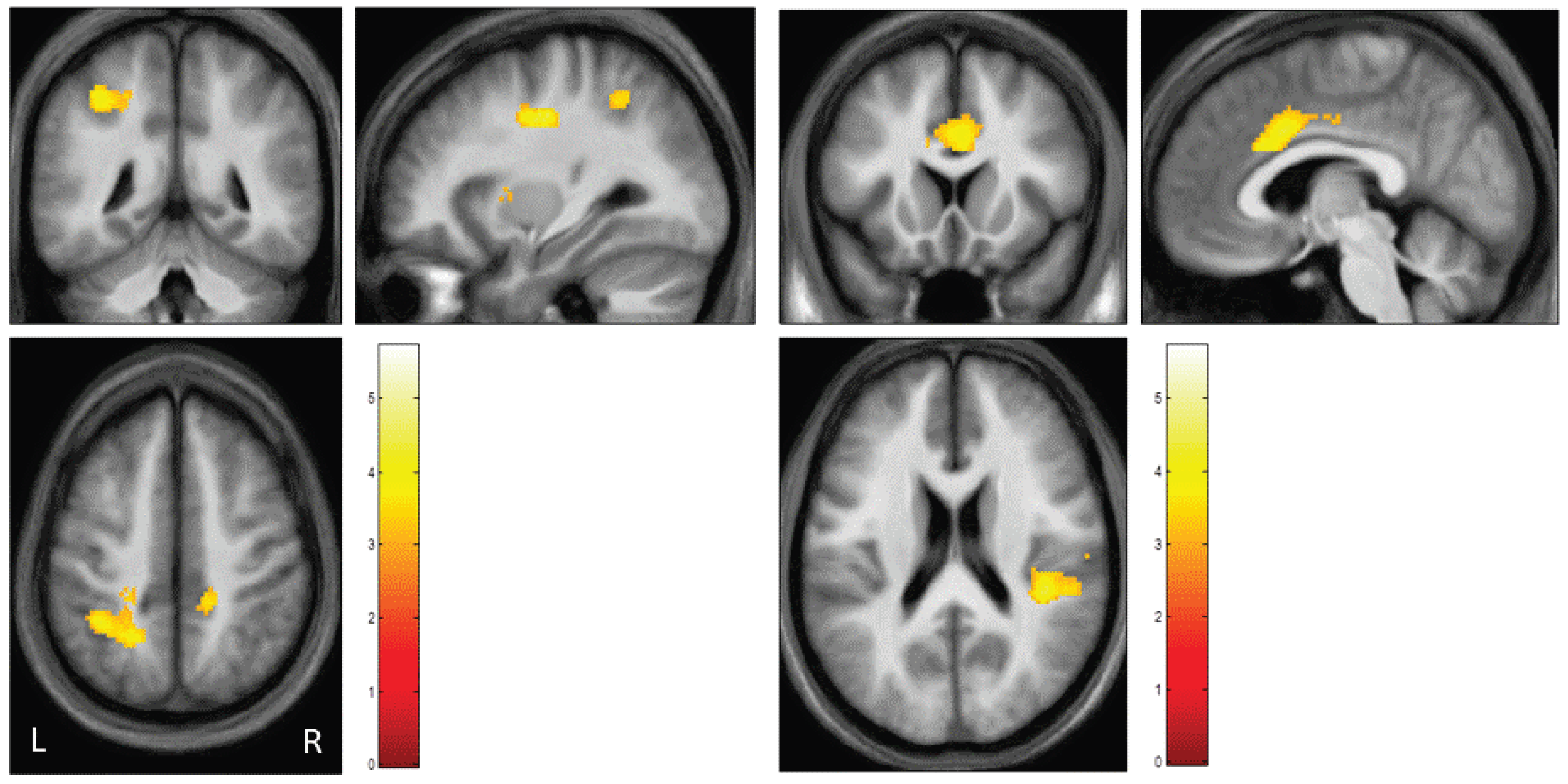 Brainsci 13 01125 g003 Brainsci 13 01125 g003