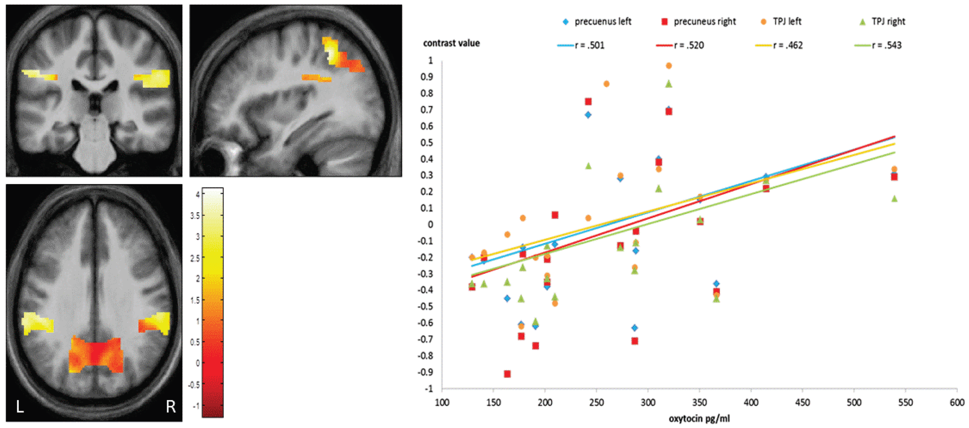 Brainsci 13 01125 g004 Brainsci 13 01125 g004