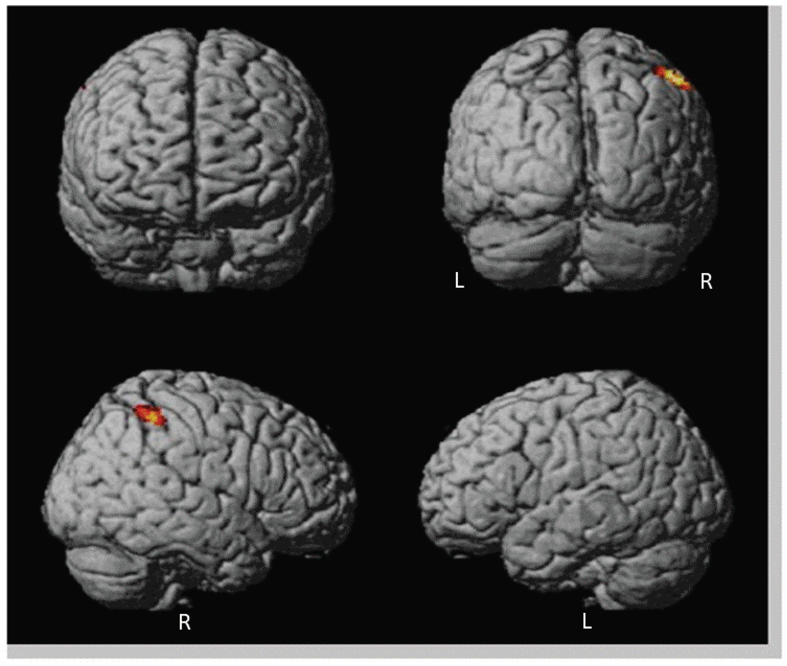 Brainsci 13 01125 g005 Brainsci 13 01125 g005