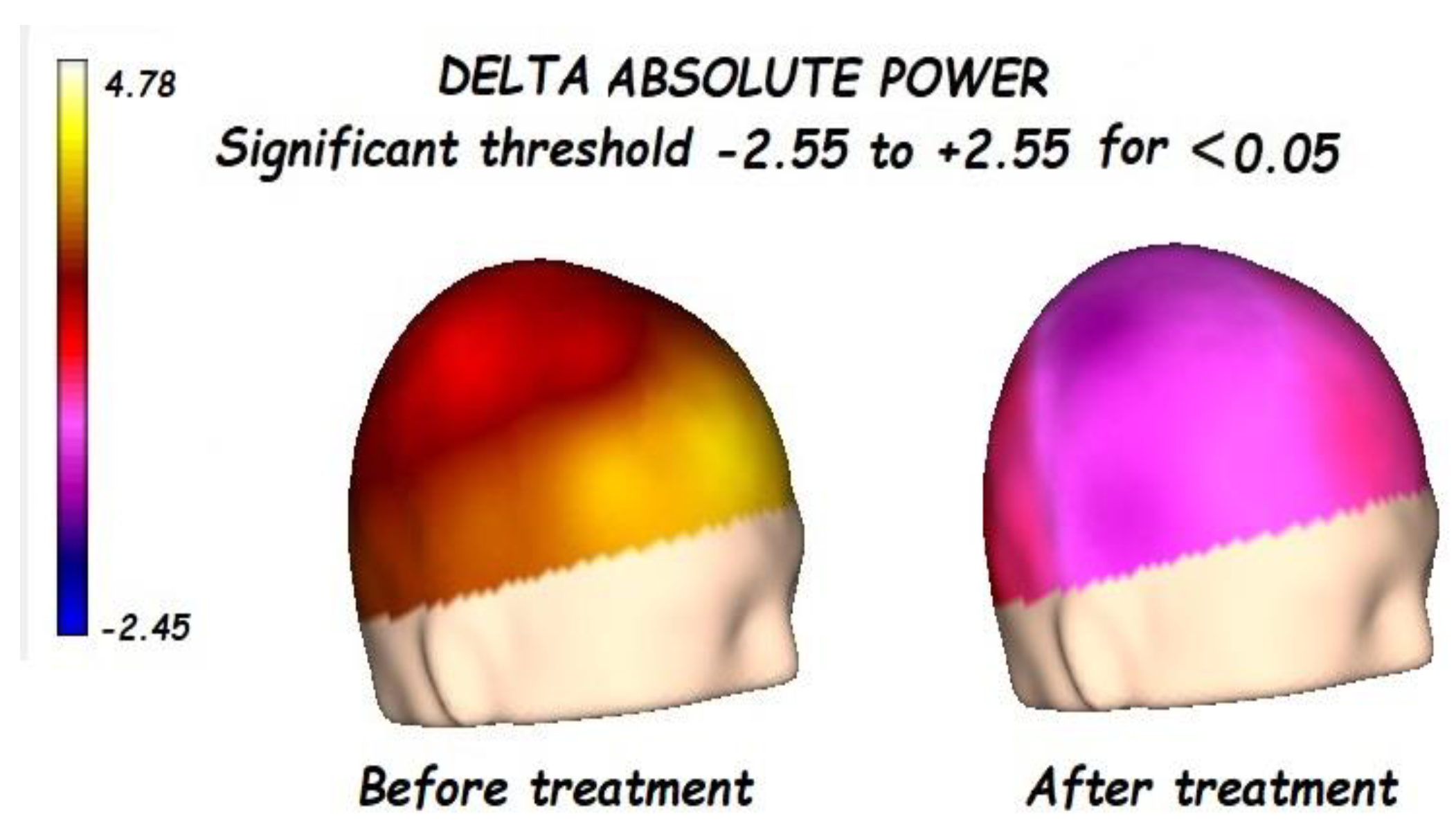 Brainsci 13 01147 g001