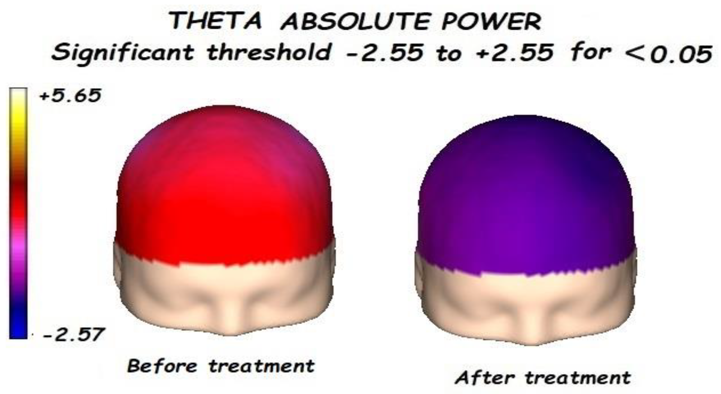 Brainsci 13 01147 g002