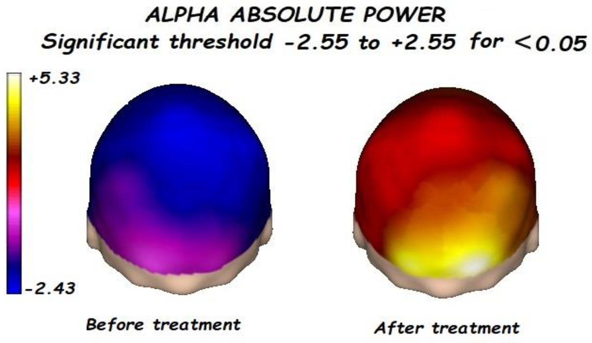 Brainsci 13 01147 g003