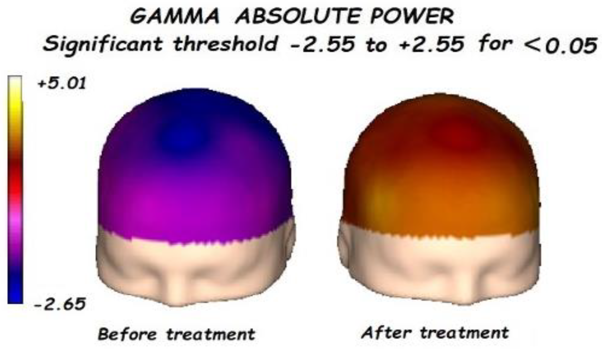 Brainsci 13 01147 g004