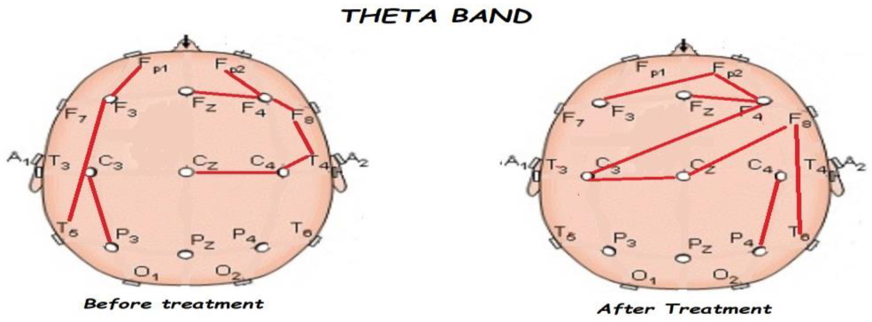 Brainsci 13 01147 g006