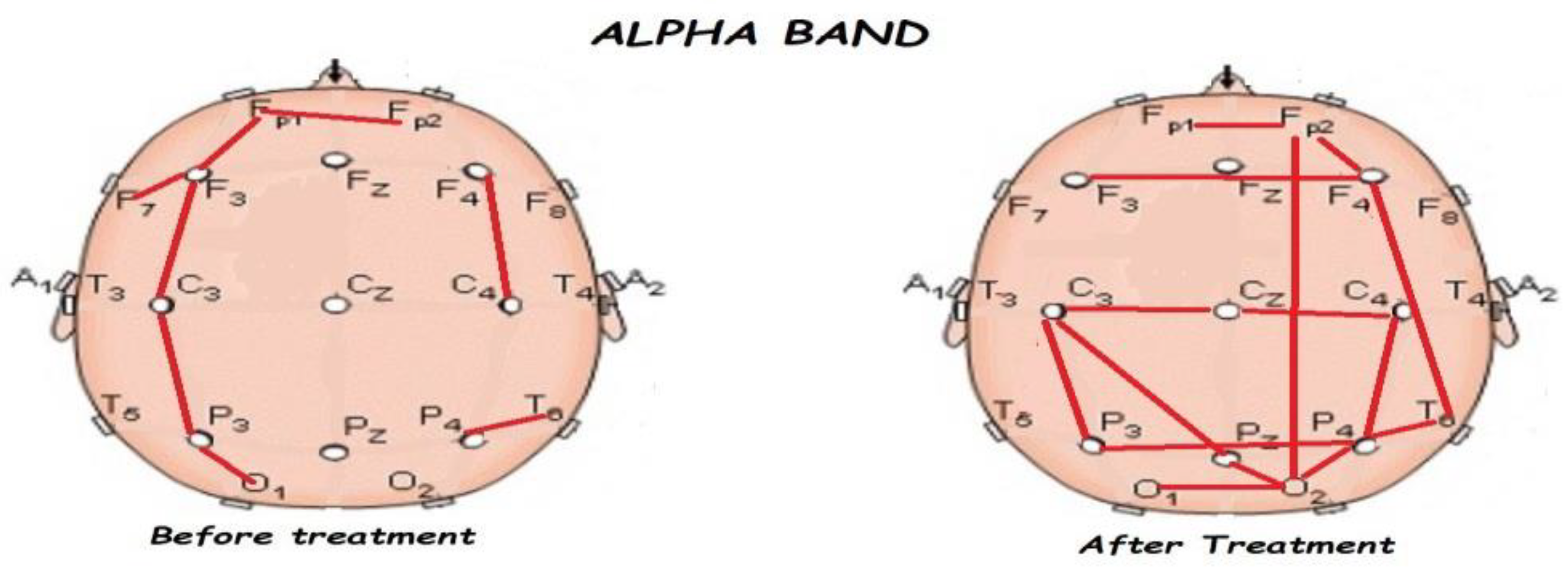 Brainsci 13 01147 g007