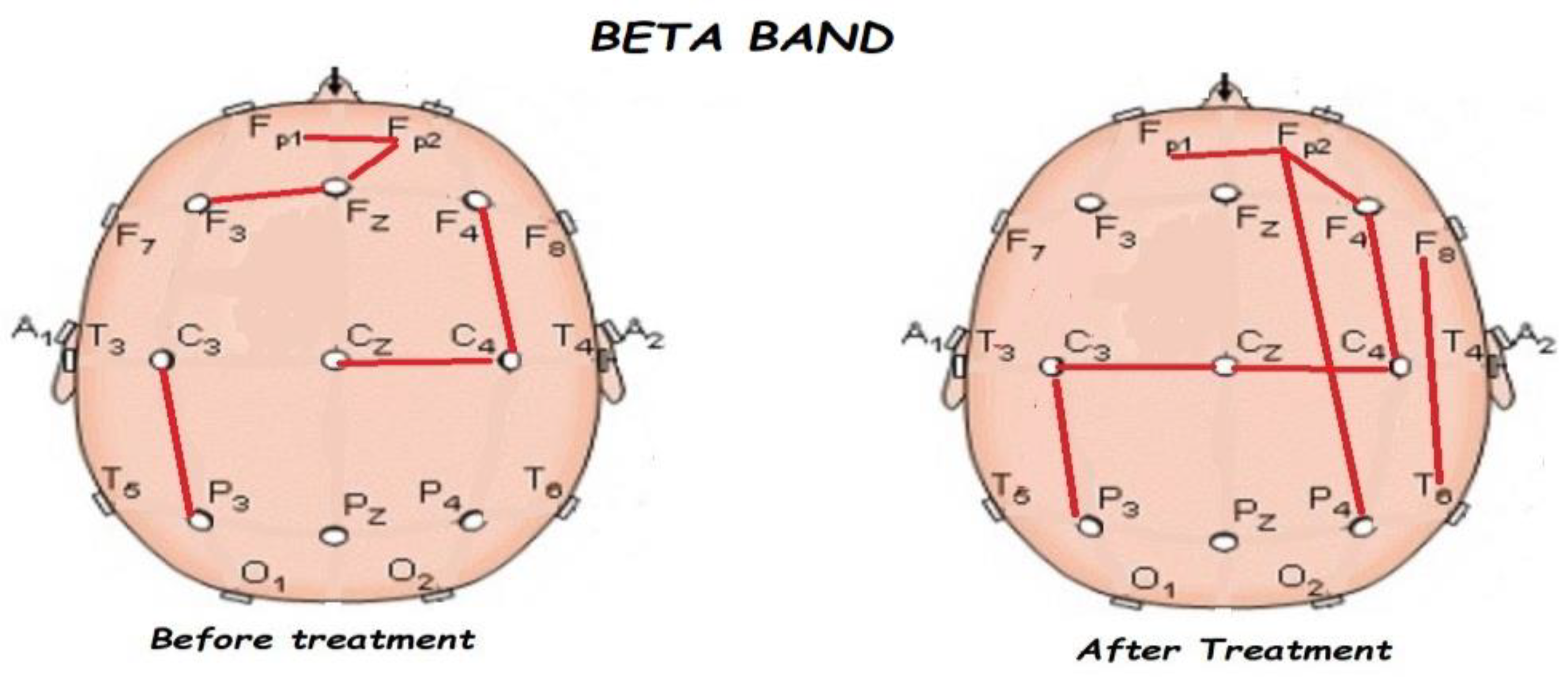 Brainsci 13 01147 g008