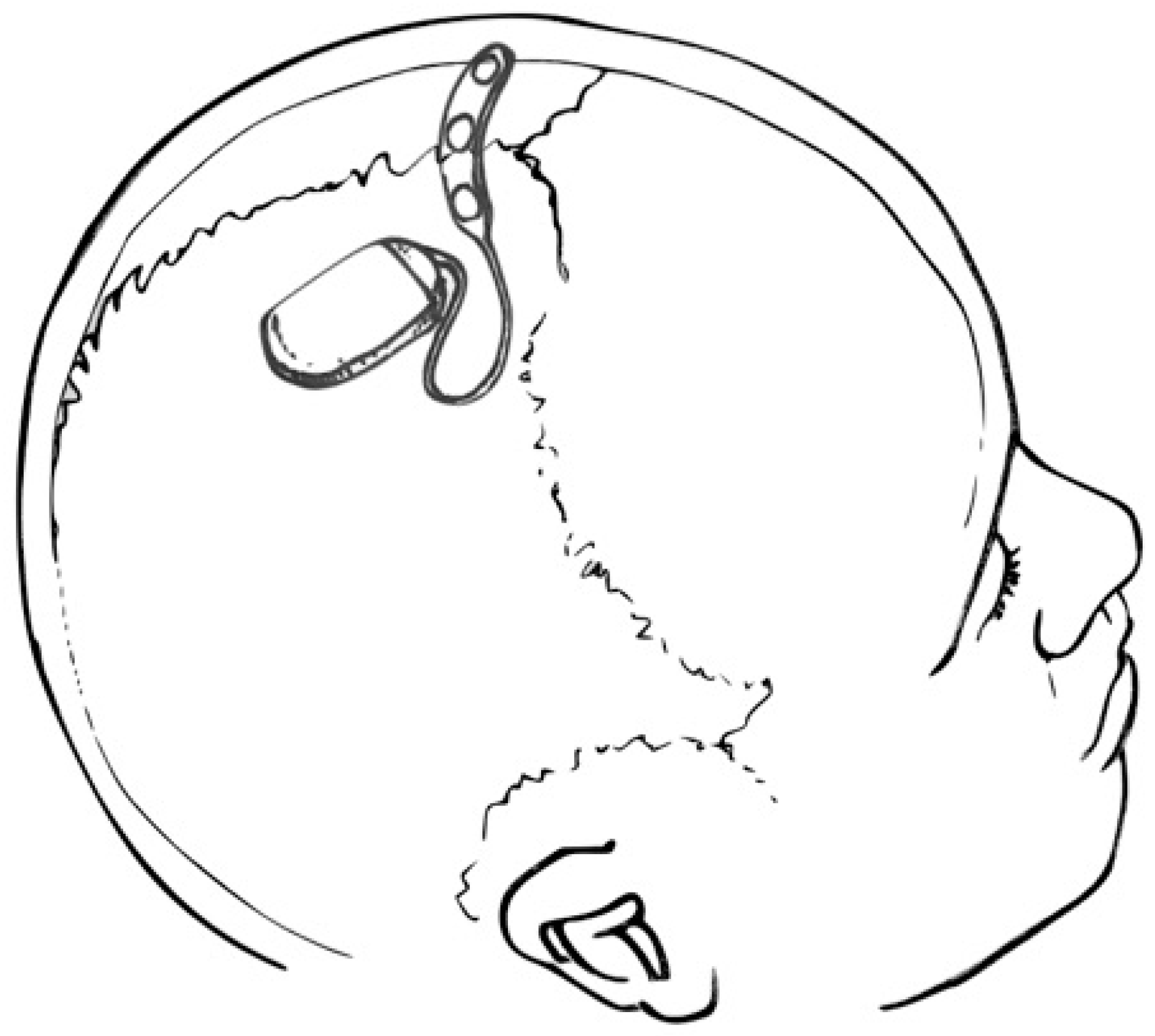 Brainsci 13 01176 g002