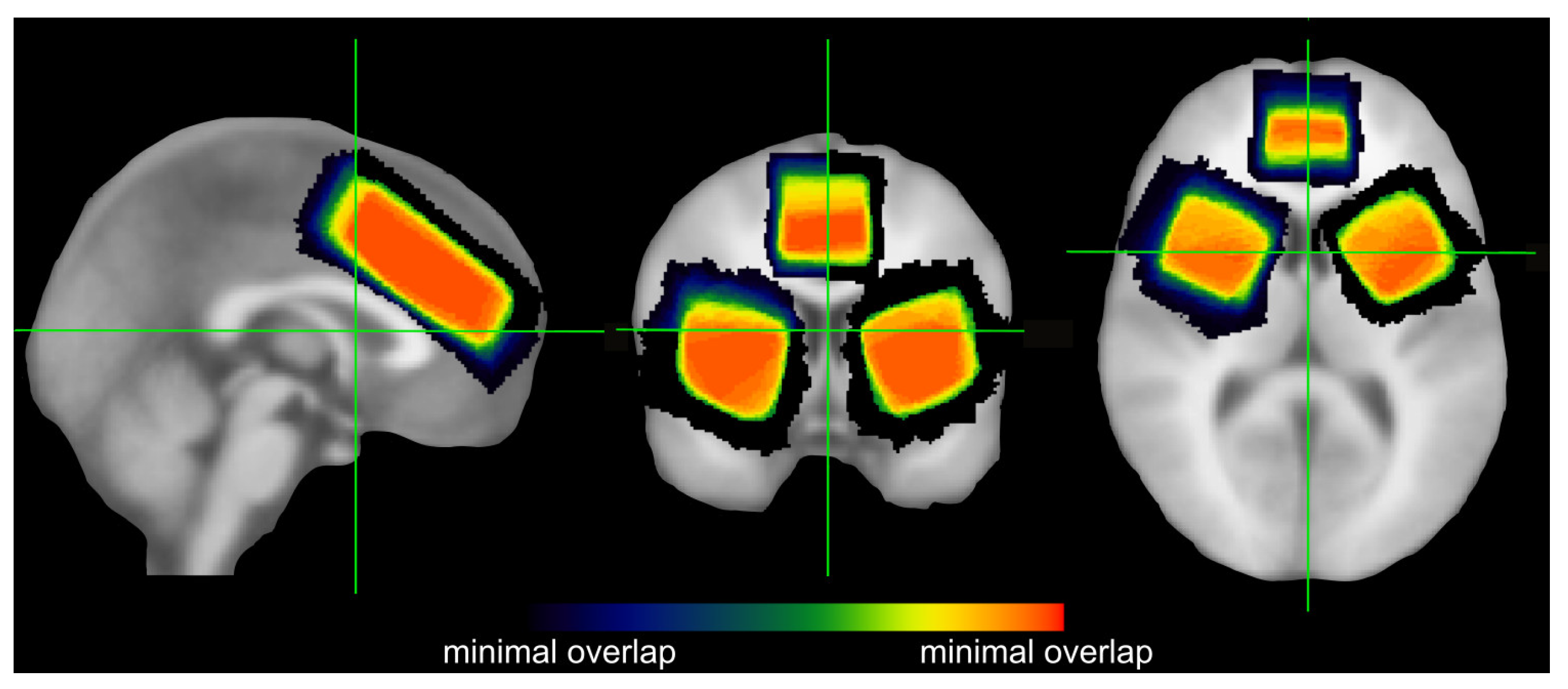 Brainsci 13 01192 g001