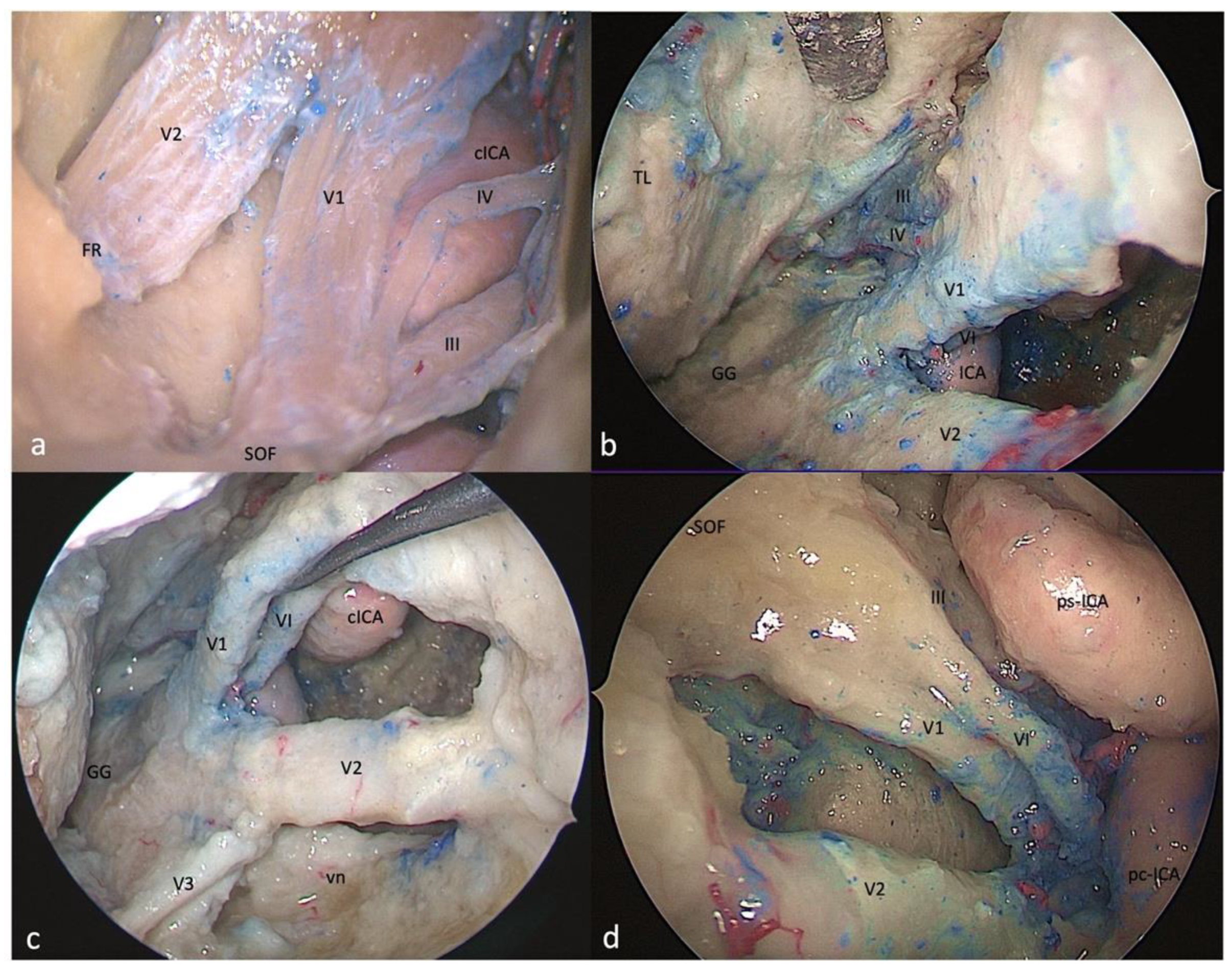 Brainsci 13 01215 g004
