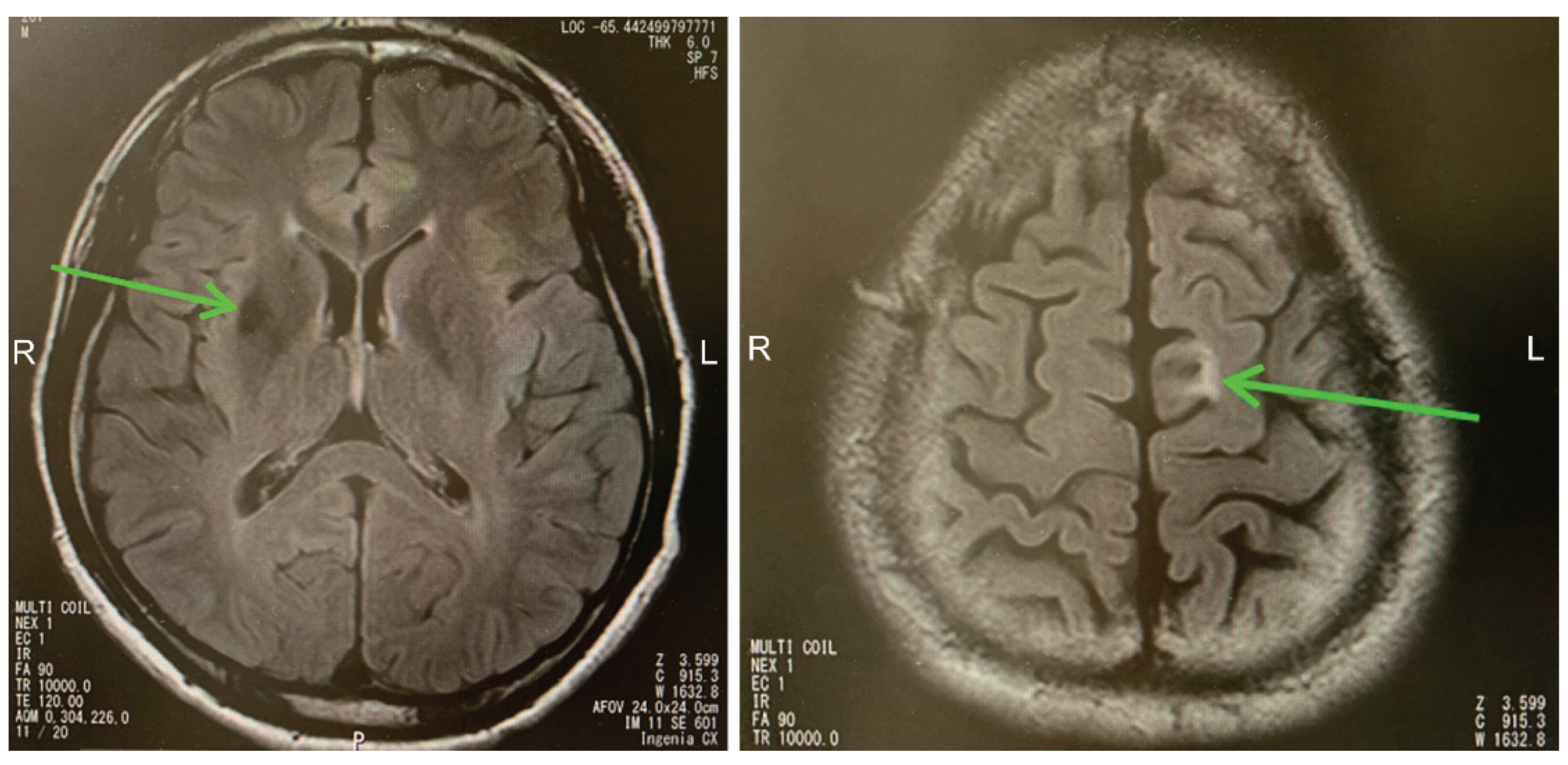 Brainsci 13 01227 g001