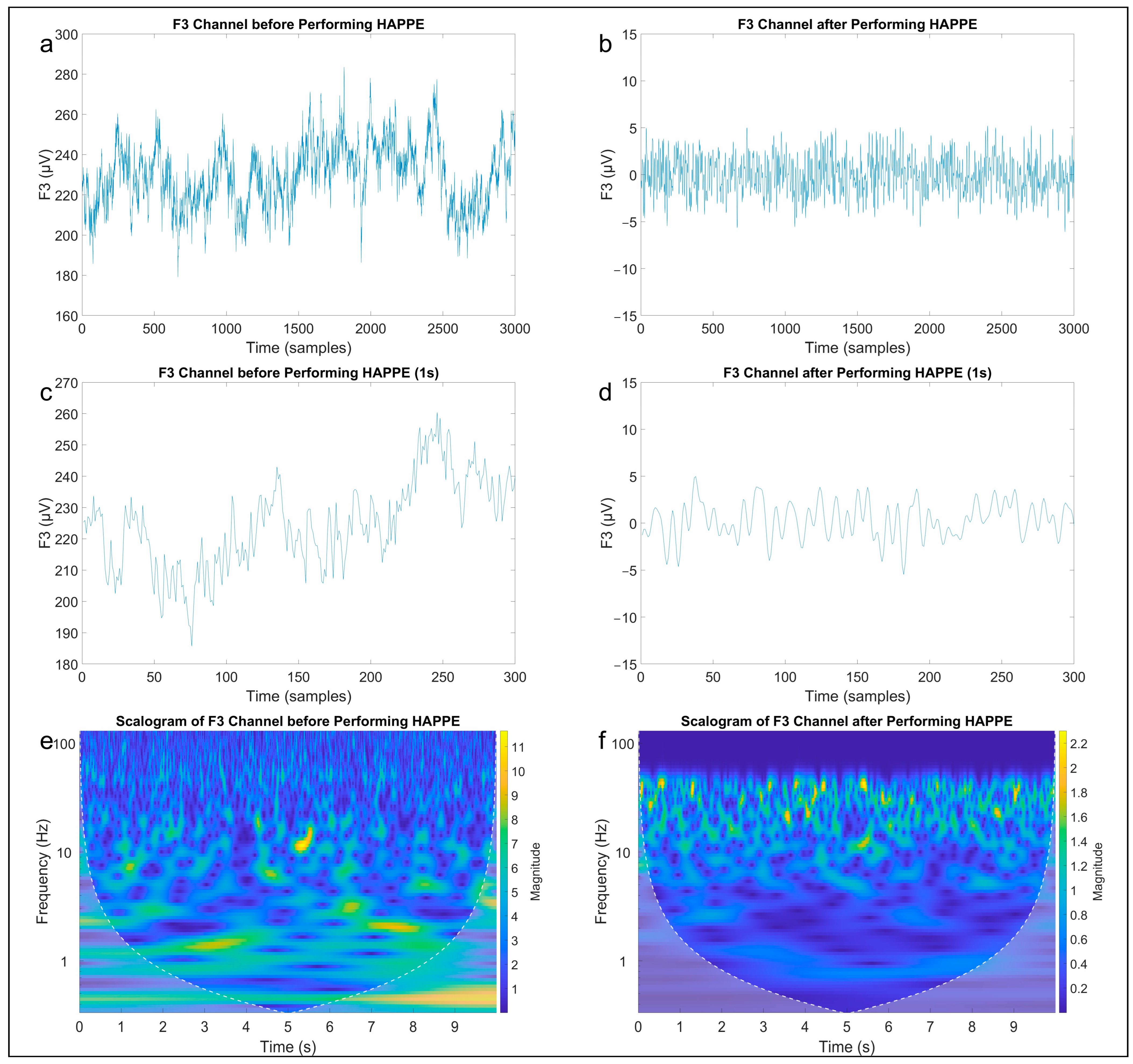 Brainsci 13 01233 g003