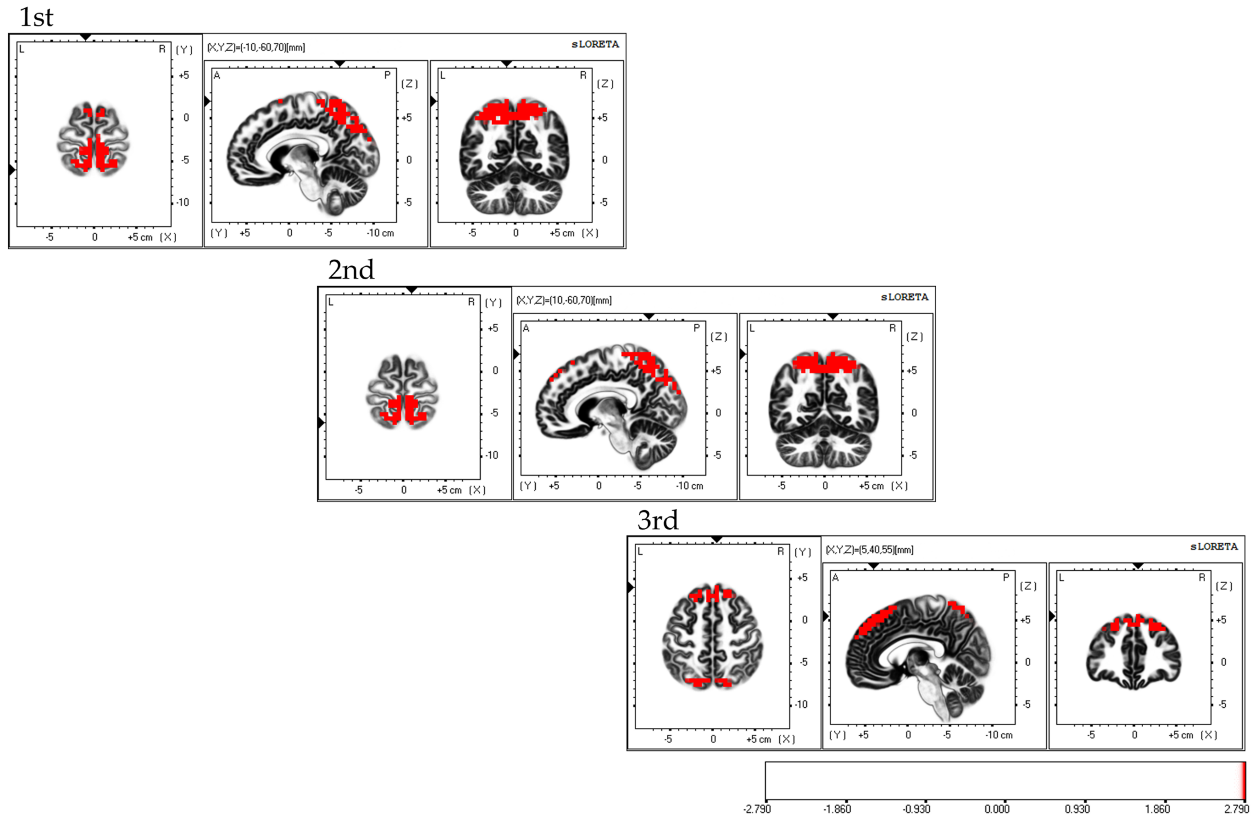Brainsci 13 01237 g005
