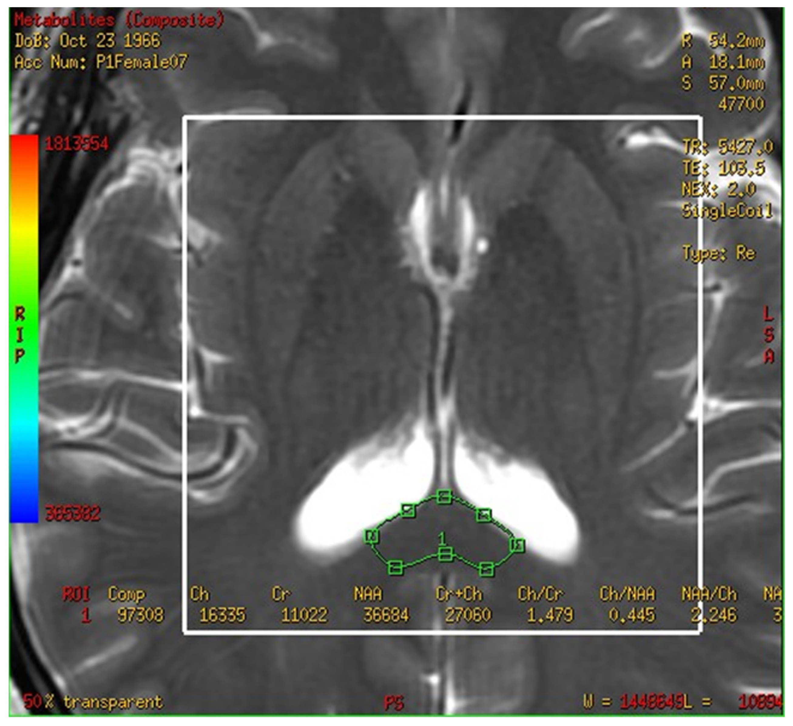 Brainsci 13 01244 g002