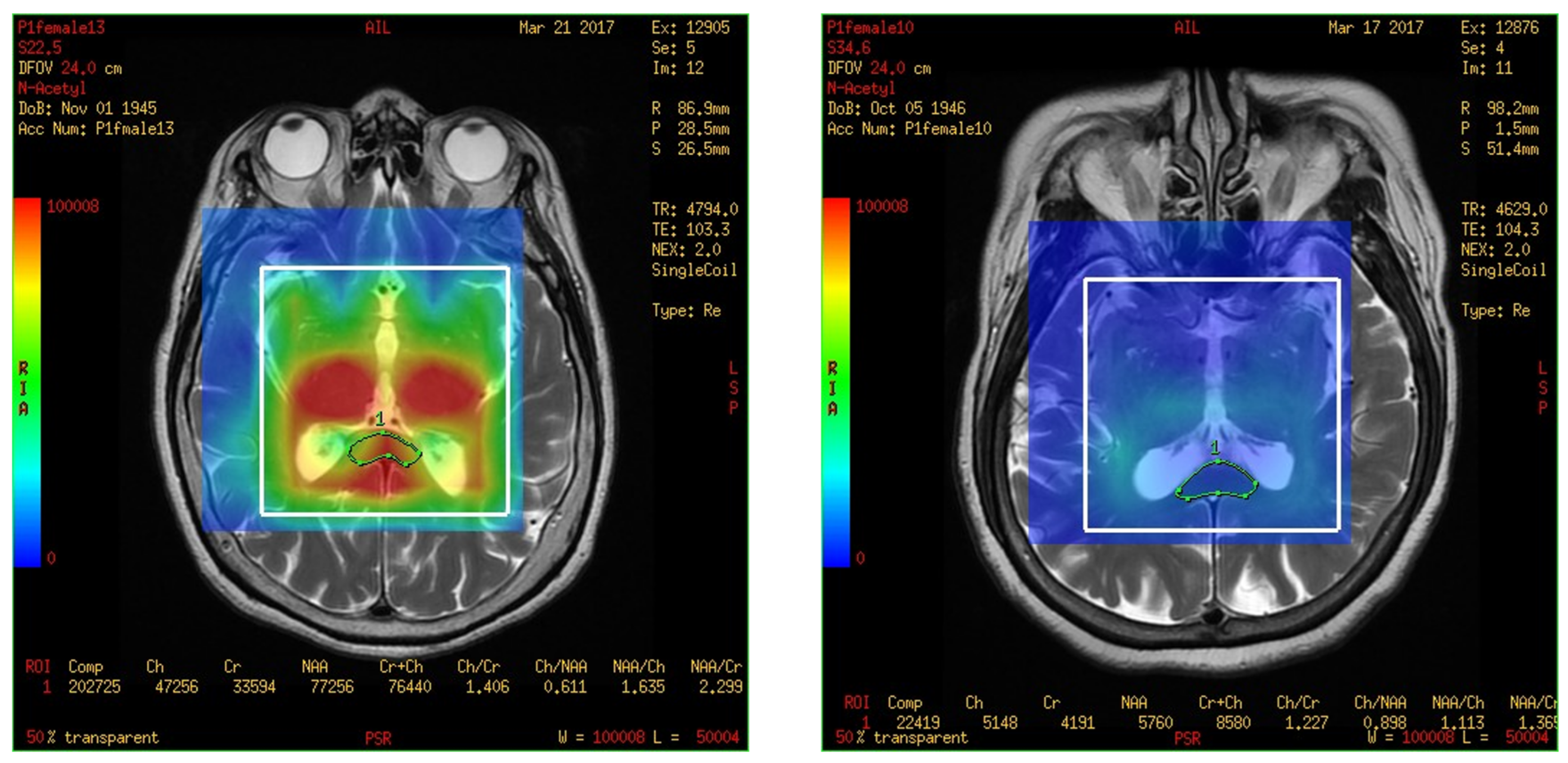 Brainsci 13 01244 g004