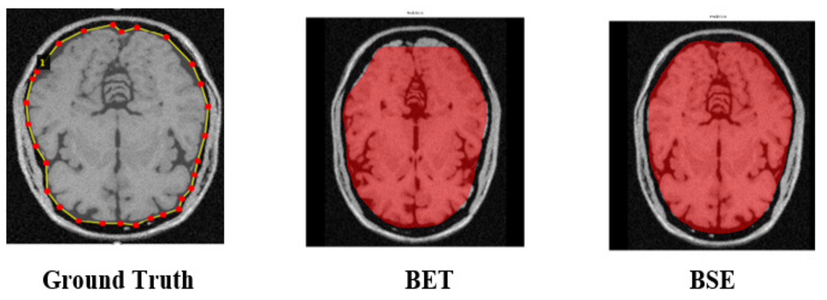 Brainsci 13 01255 g004
