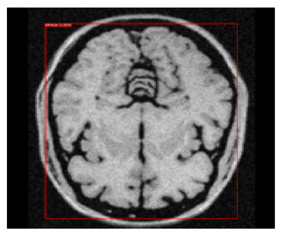 Brainsci 13 01255 g011