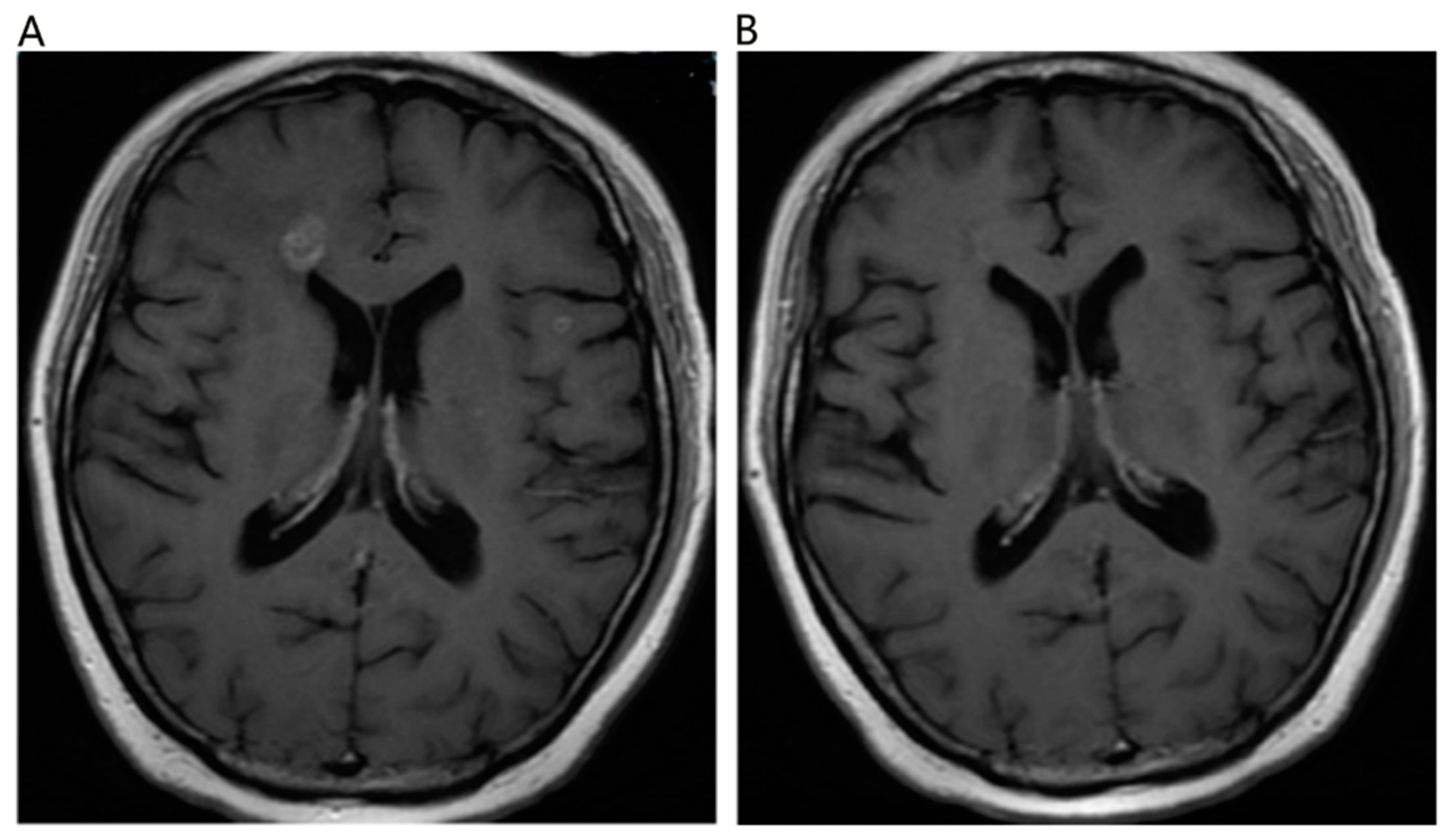 Brainsci 13 01280 g004