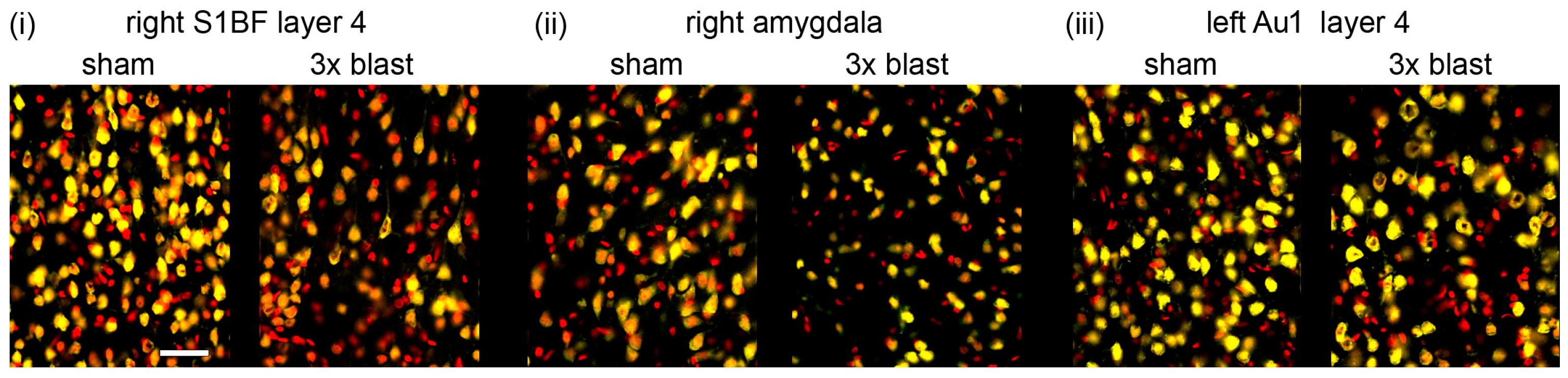 Brainsci 13 01298 g007