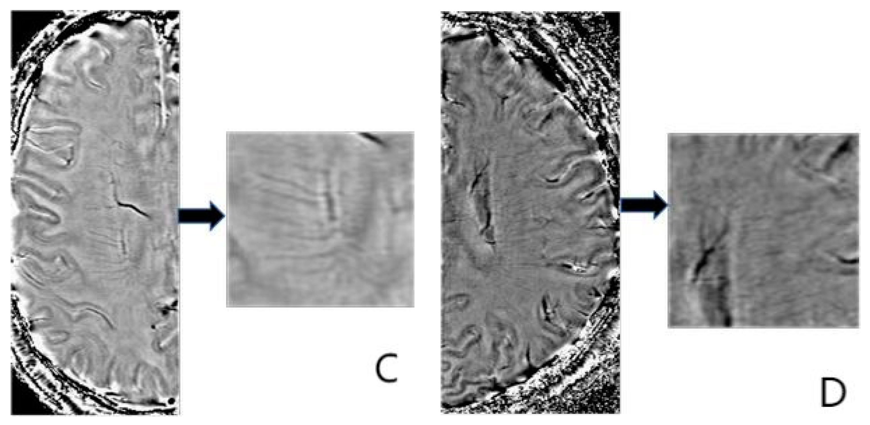 Brainsci 13 01315 g002b