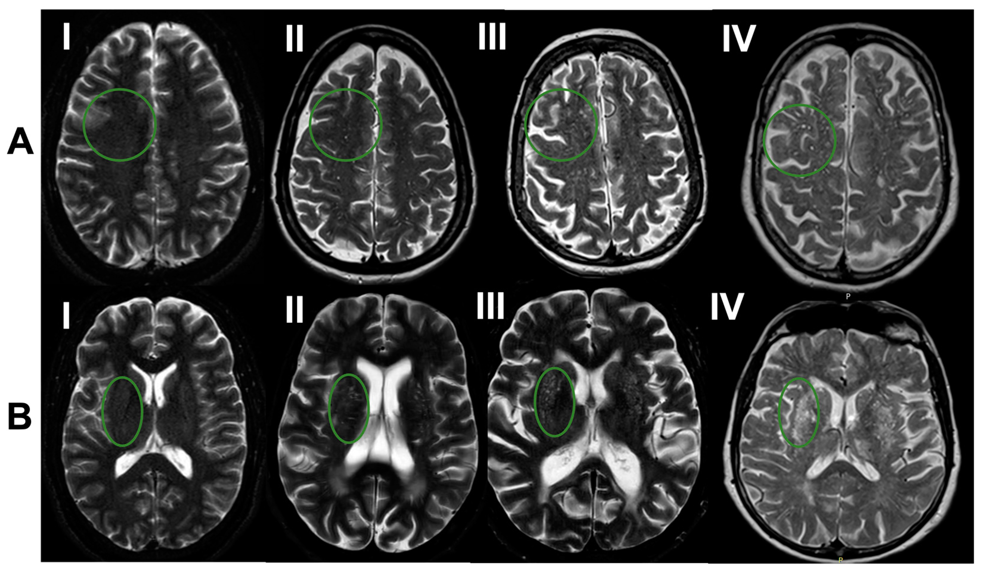 Brainsci 13 01323 g001