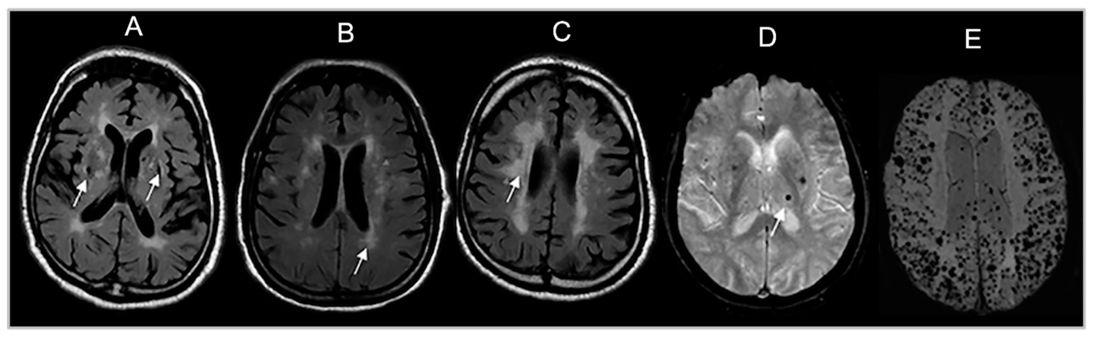 Brainsci 13 01323 g002
