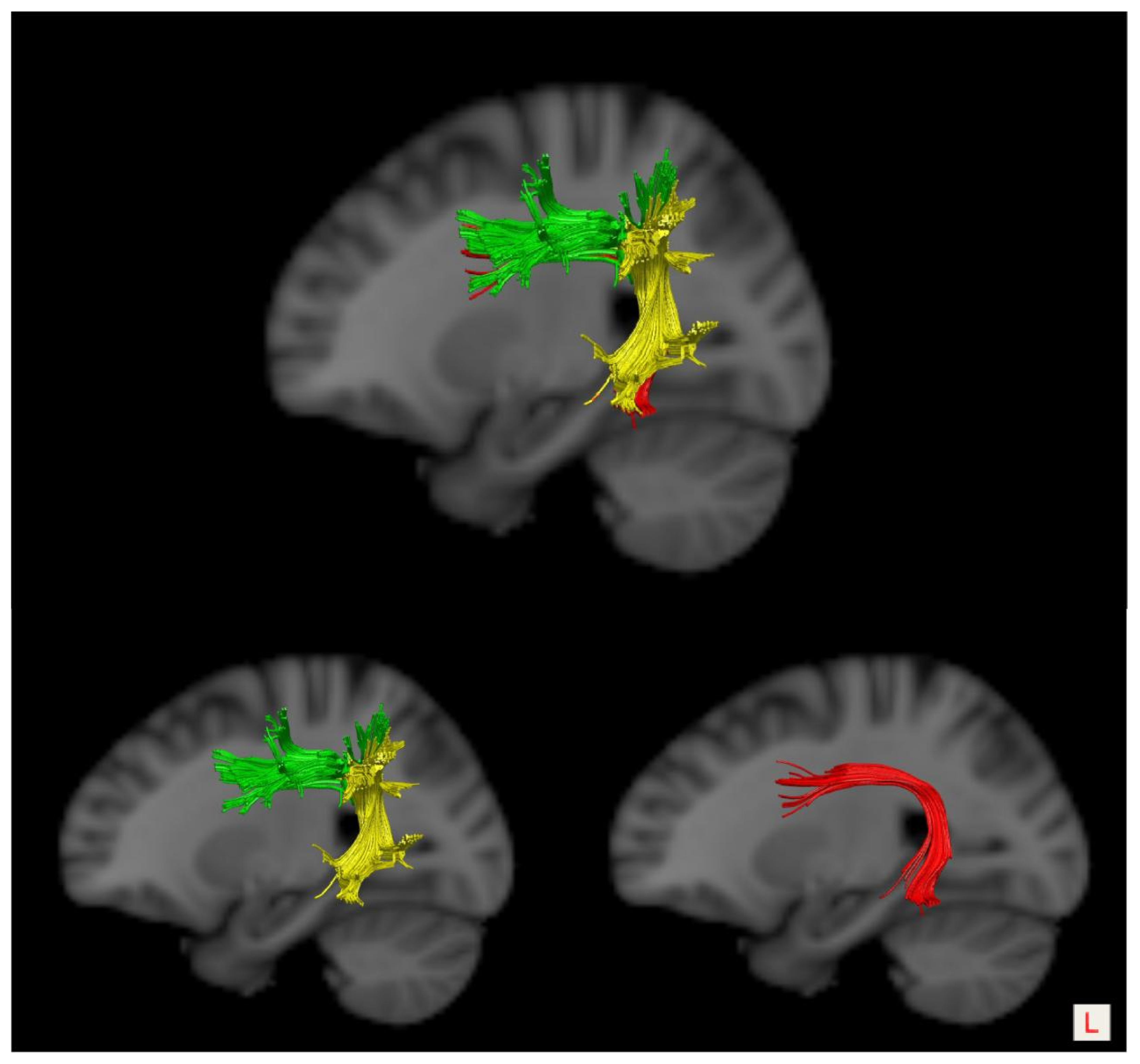 Brainsci 13 01324 g001 Brainsci 13 01324 g001