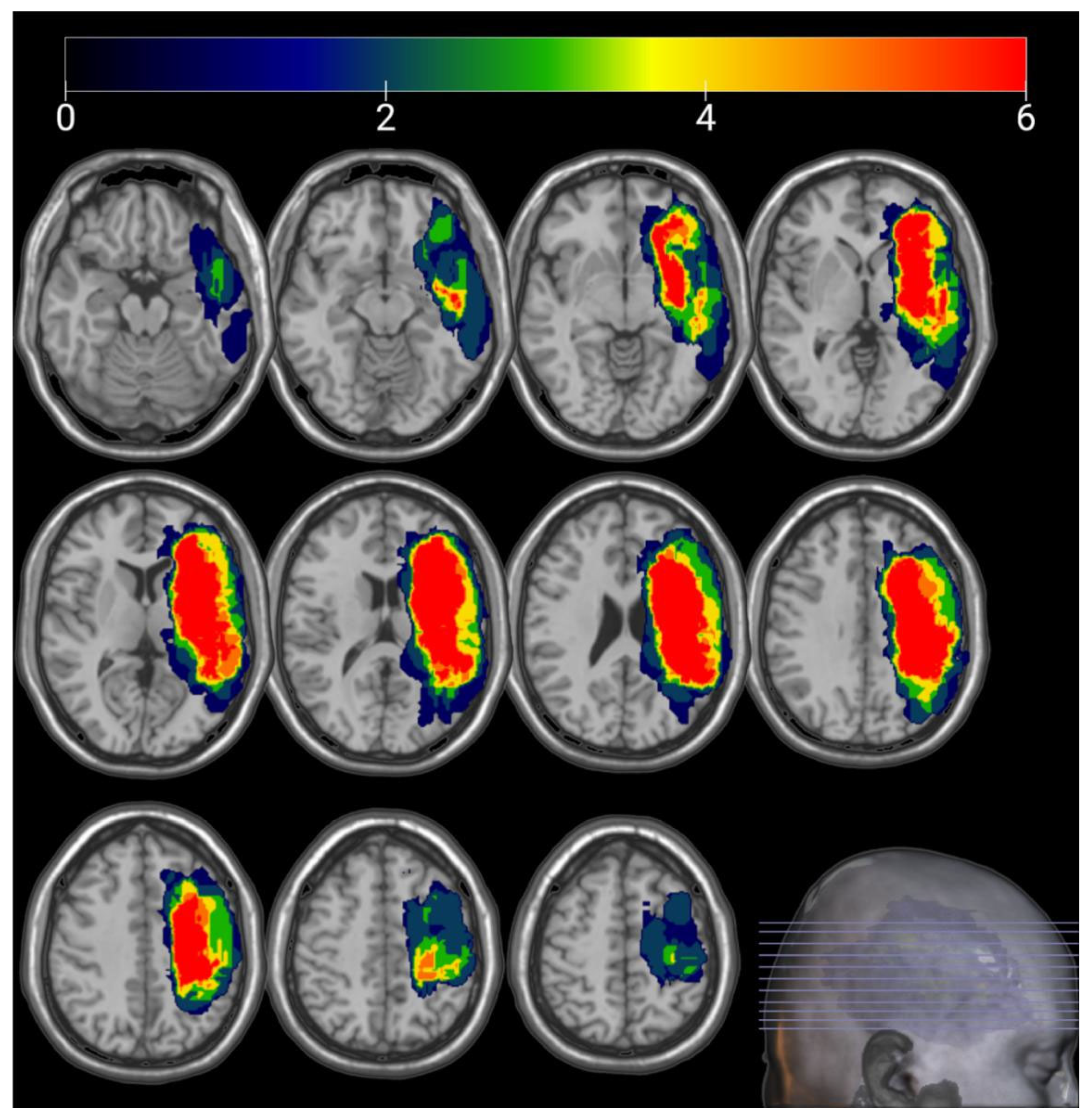 Brainsci 13 01324 g003 Brainsci 13 01324 g003
