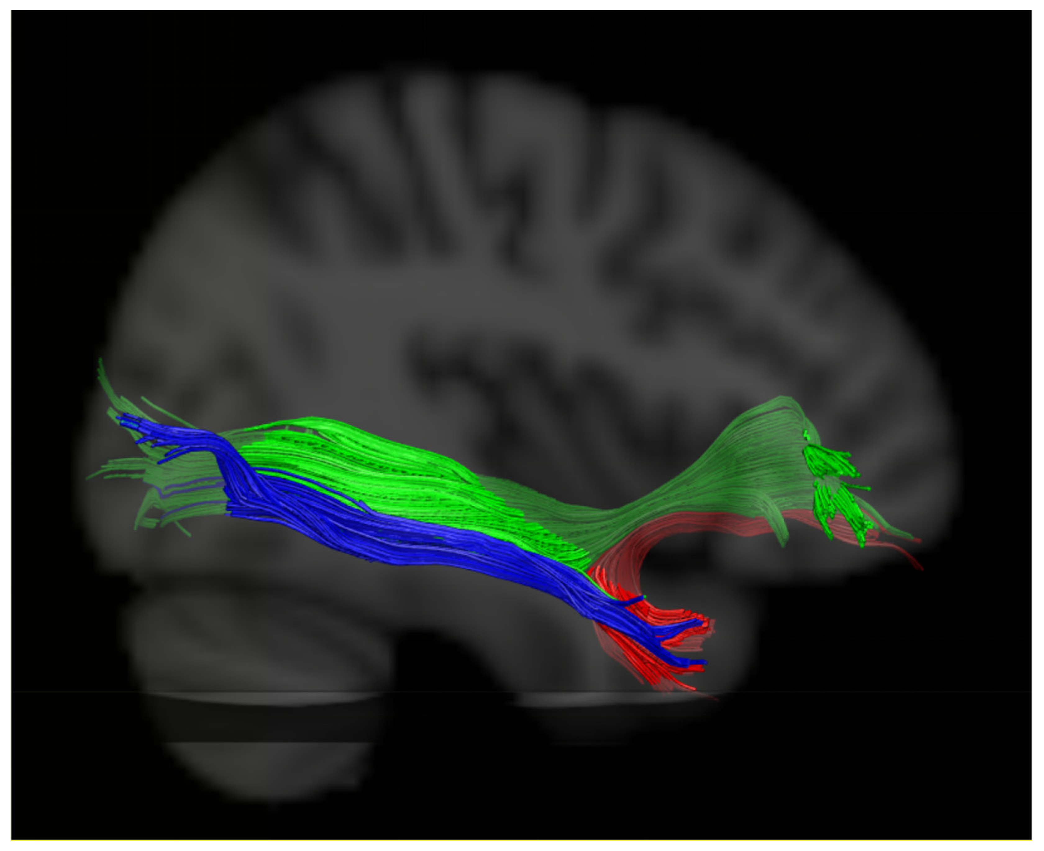 Brainsci 13 01324 g004 Brainsci 13 01324 g004