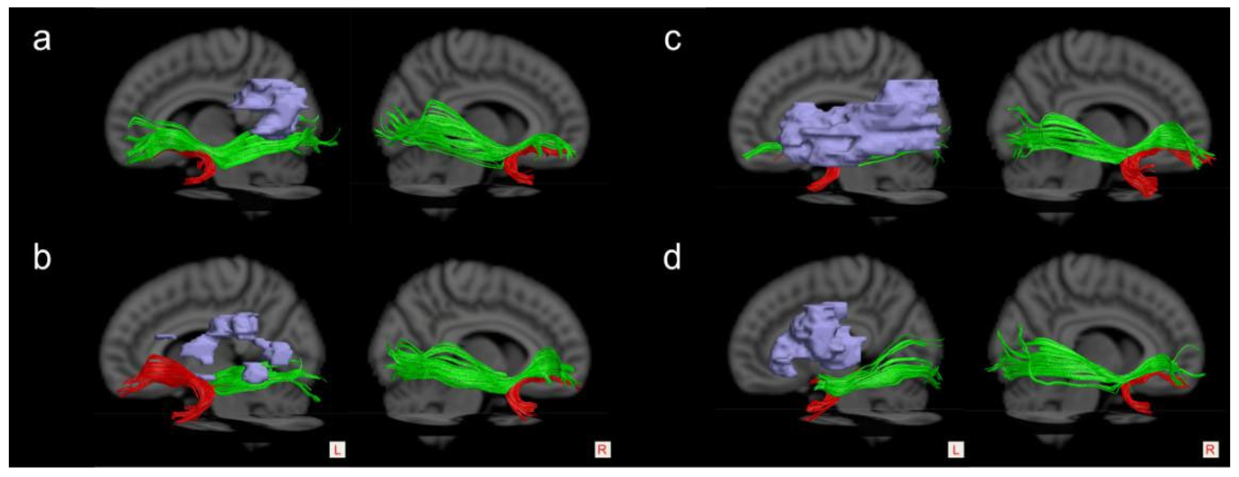 Brainsci 13 01324 g005 Brainsci 13 01324 g005