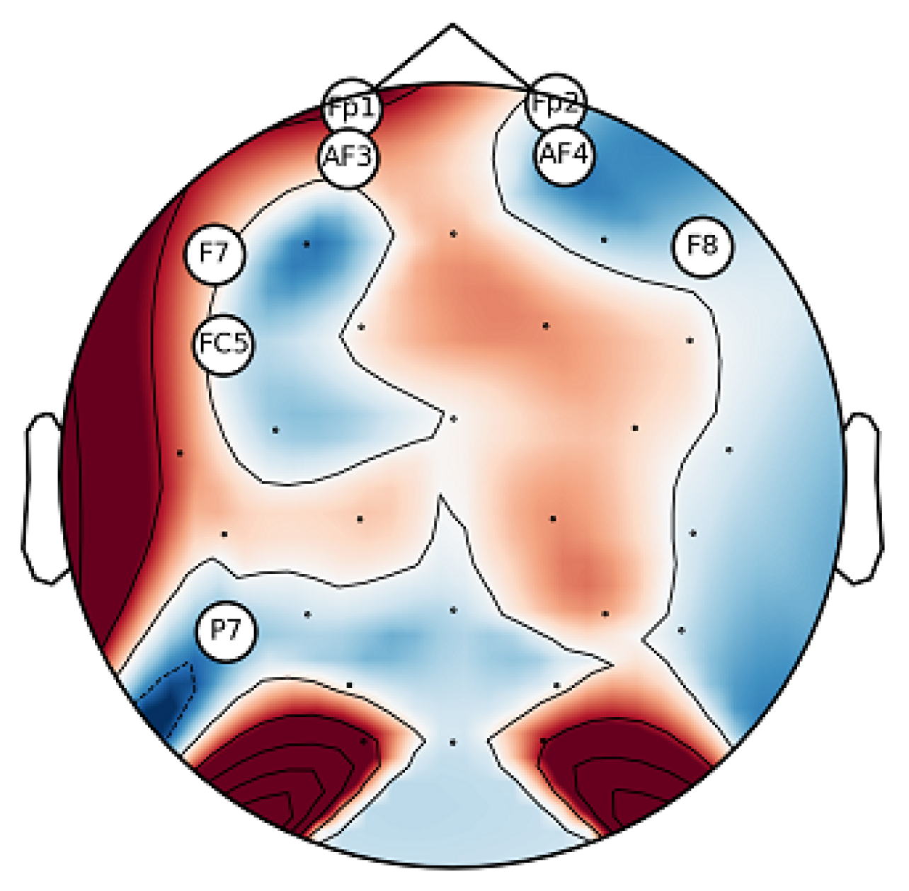 Brainsci 13 01340 g005