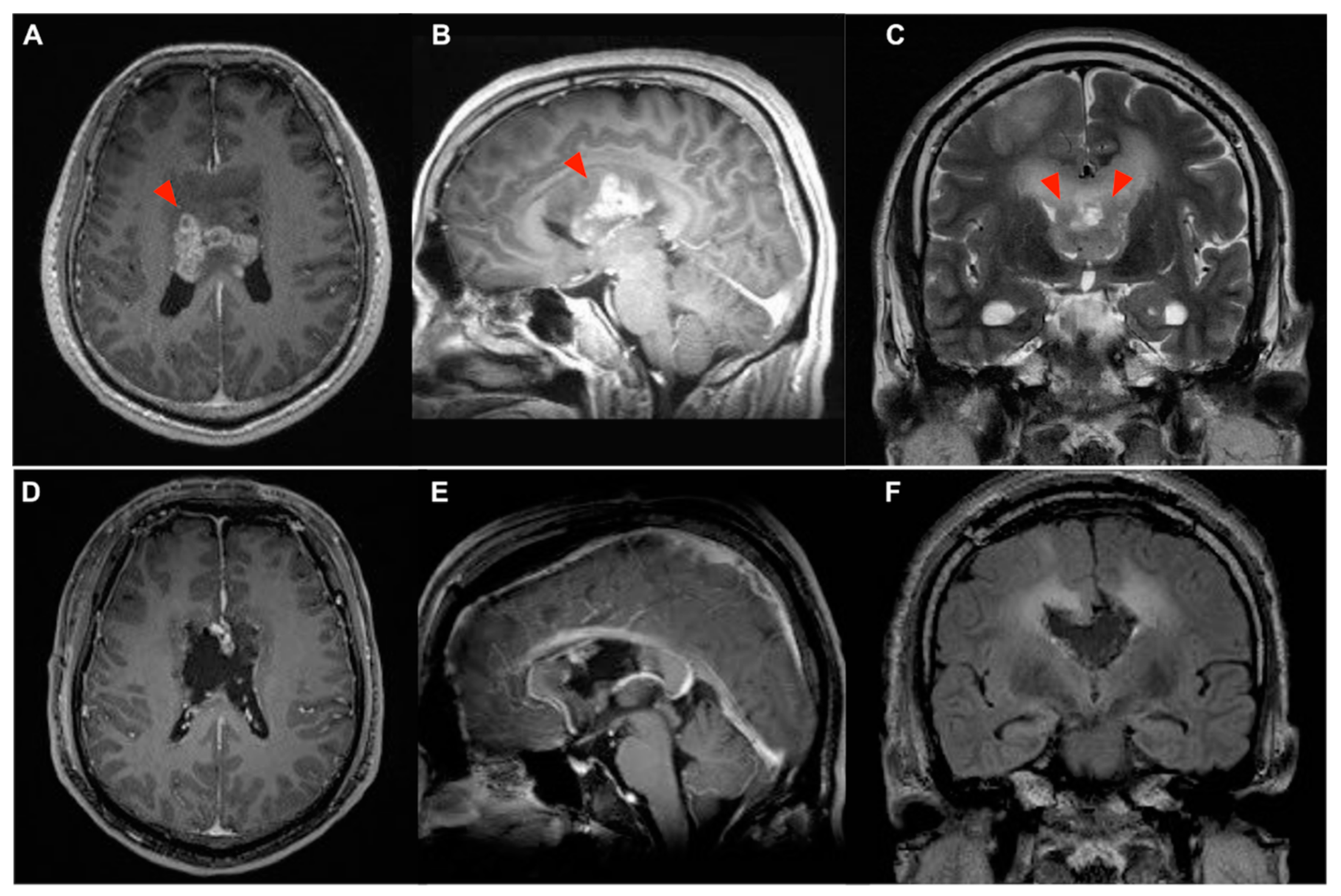 Brainsci 13 01371 g001