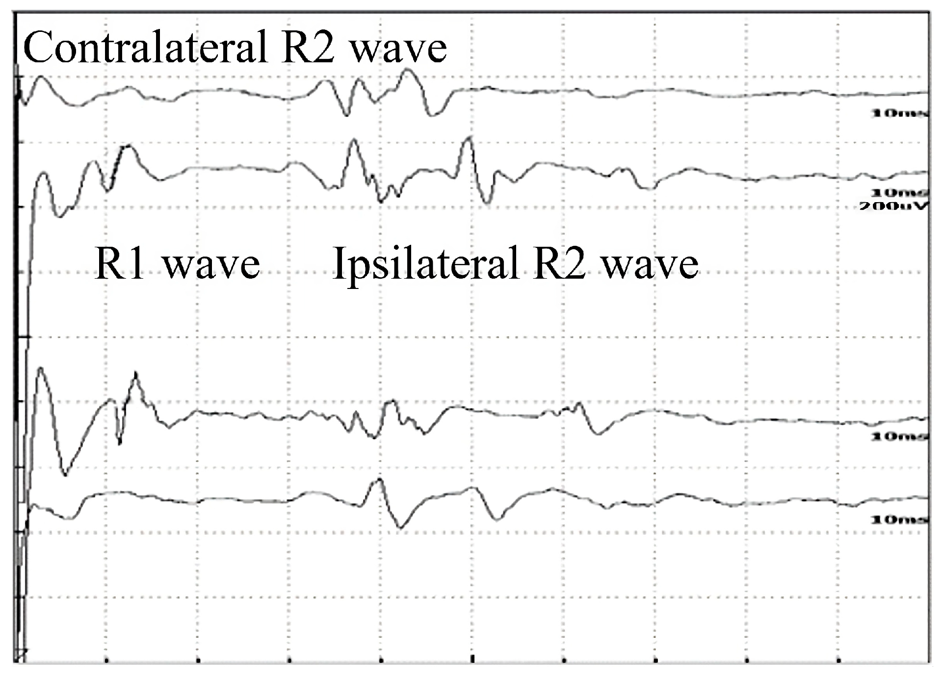 Brainsci 13 01384 g001