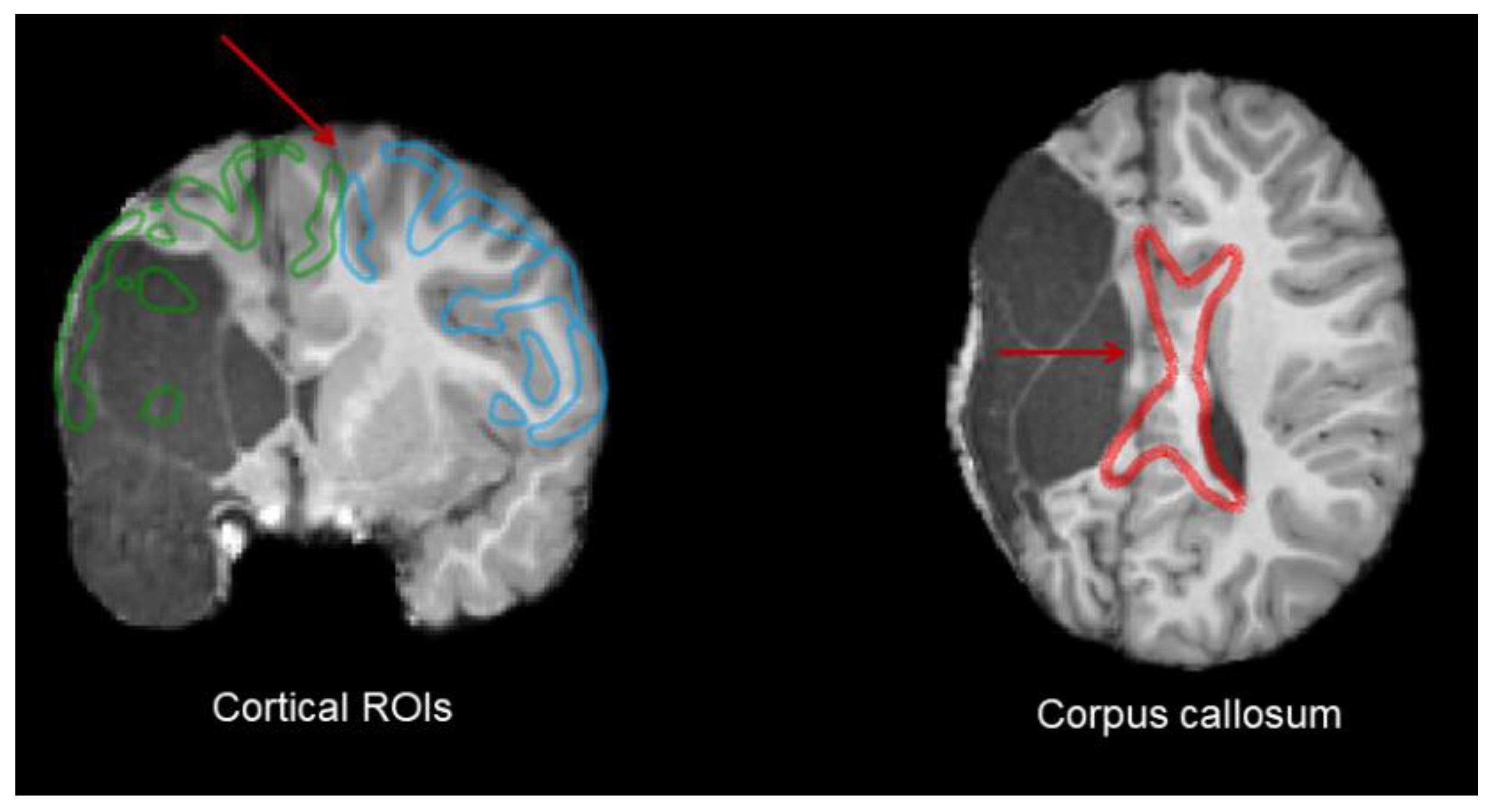 Brainsci 13 01386 g003