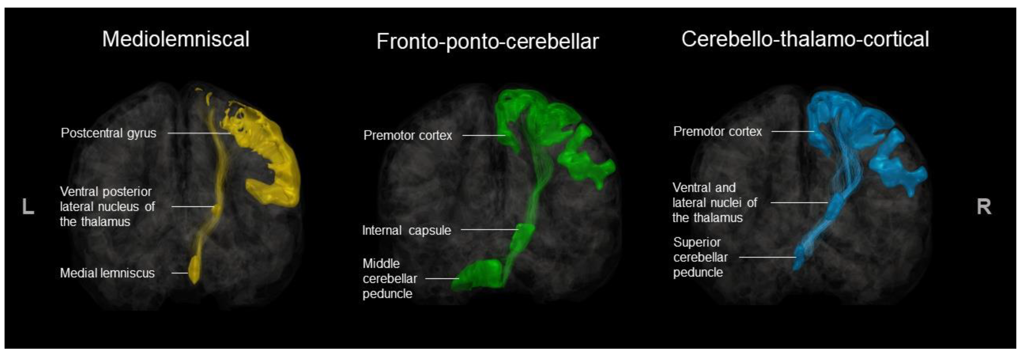 Brainsci 13 01386 g004