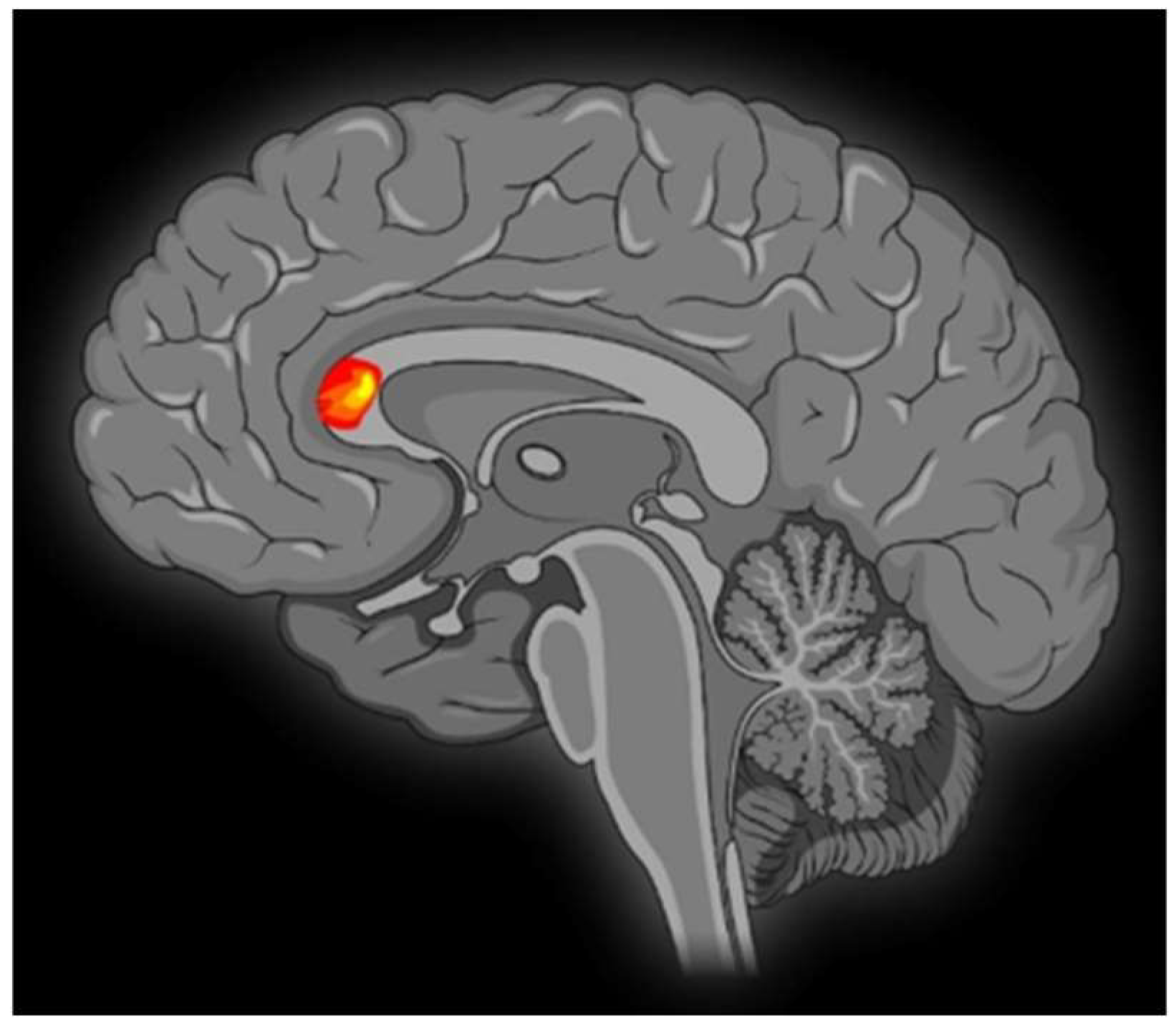 Brainsci 13 01390 g003