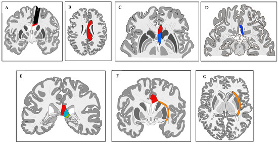 Brainsci 13 01395 g001