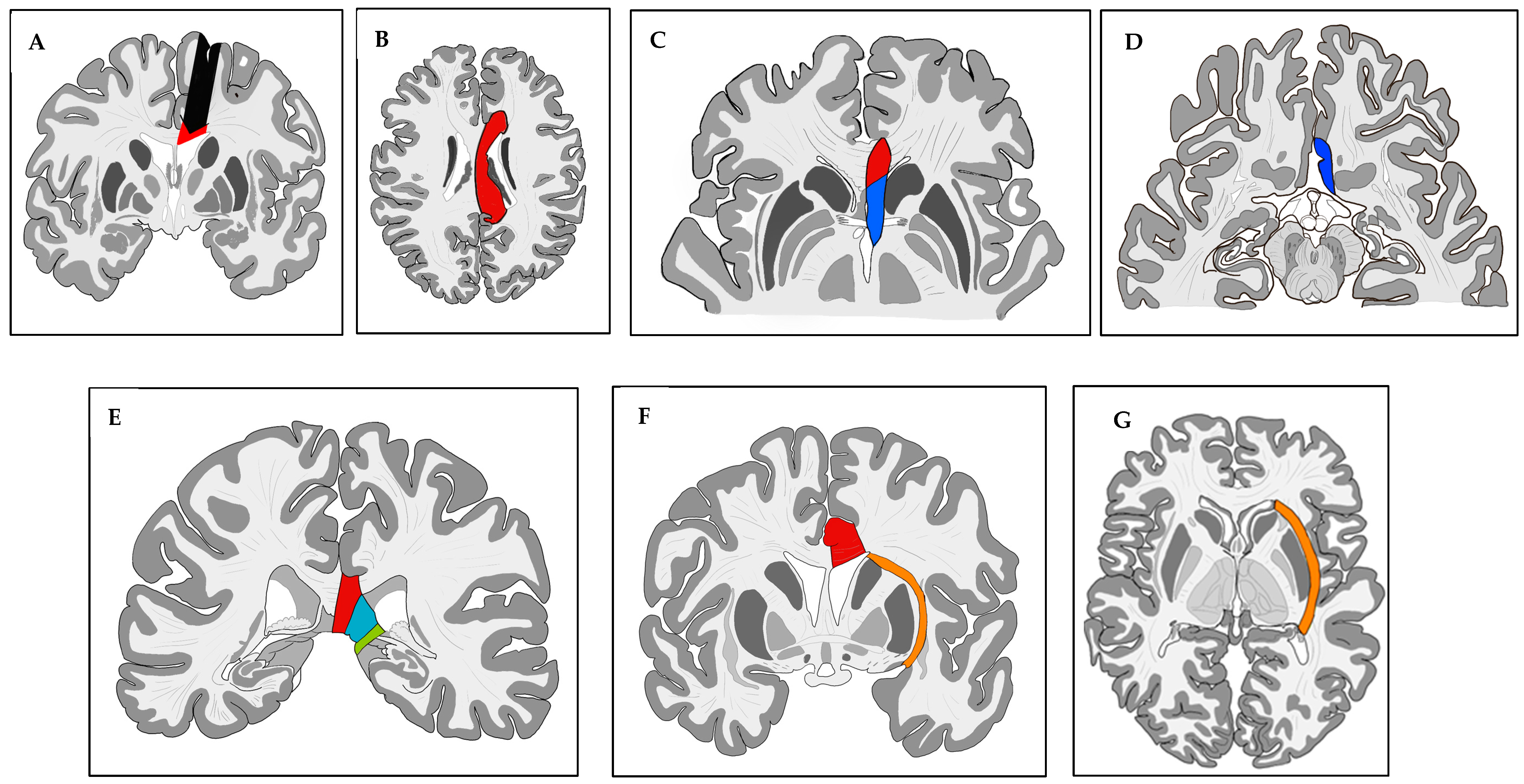 Brainsci 13 01395 g001