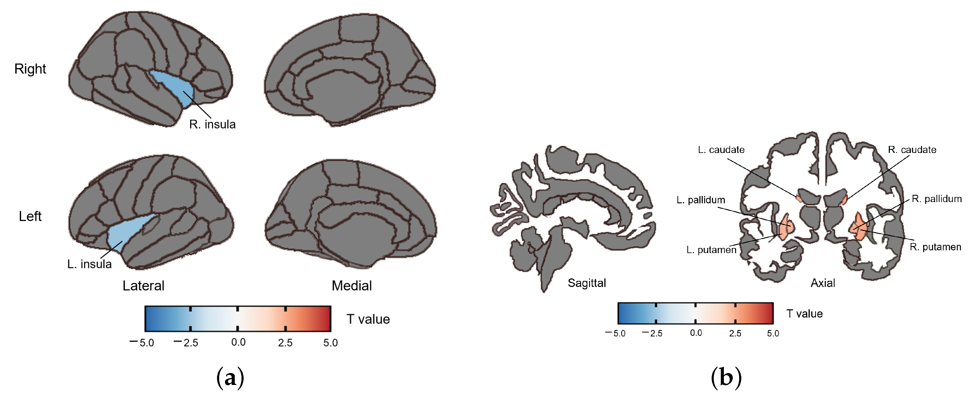 Brainsci 13 01403 g002