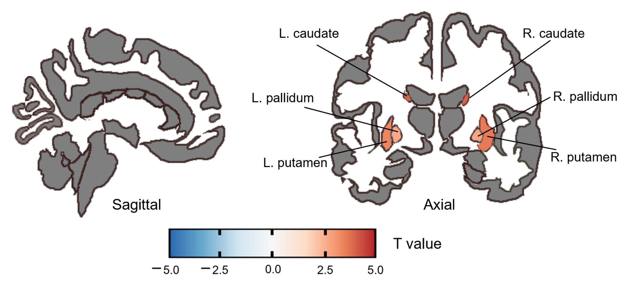 Brainsci 13 01403 g003