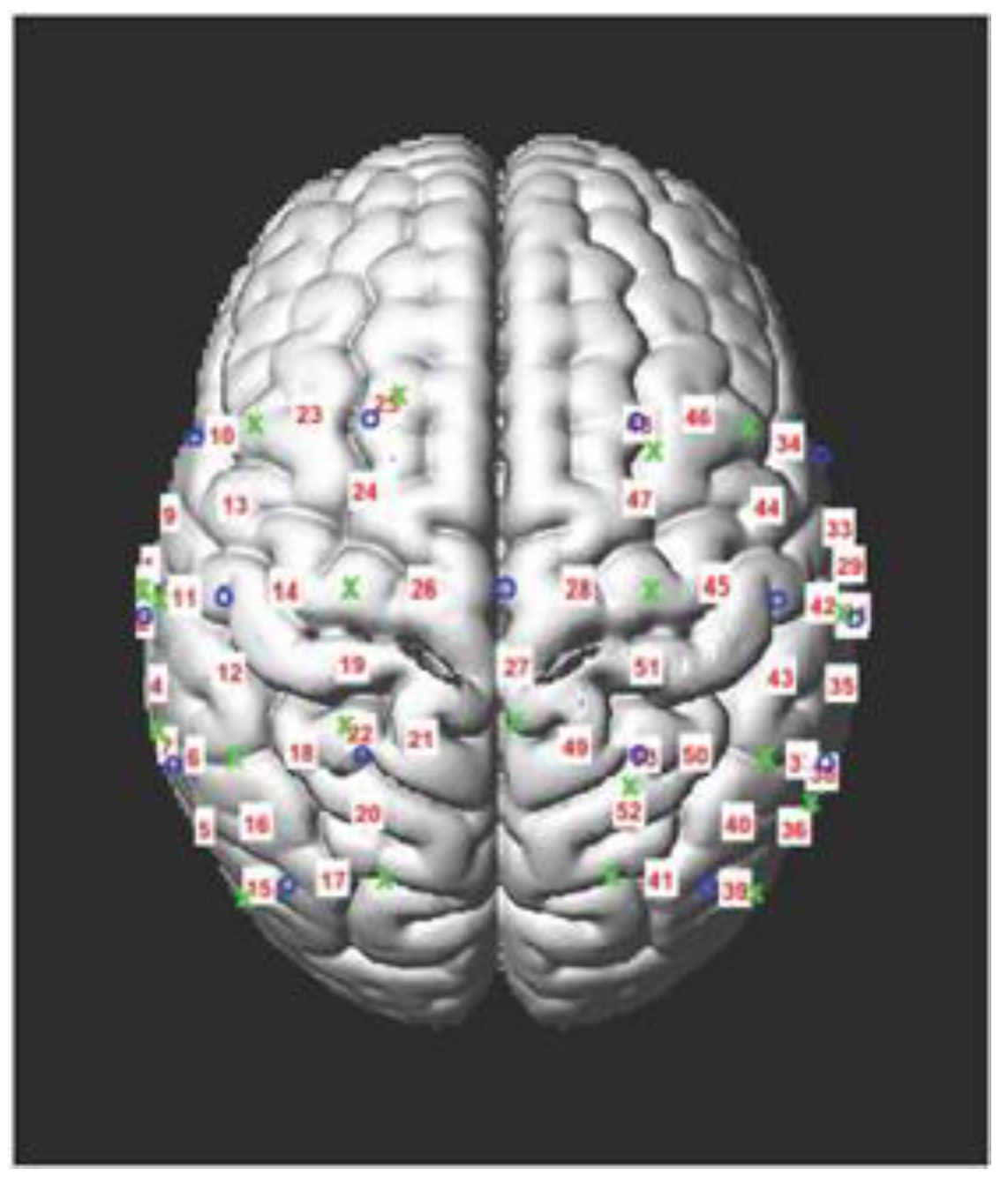 Brainsci 13 01413 g001
