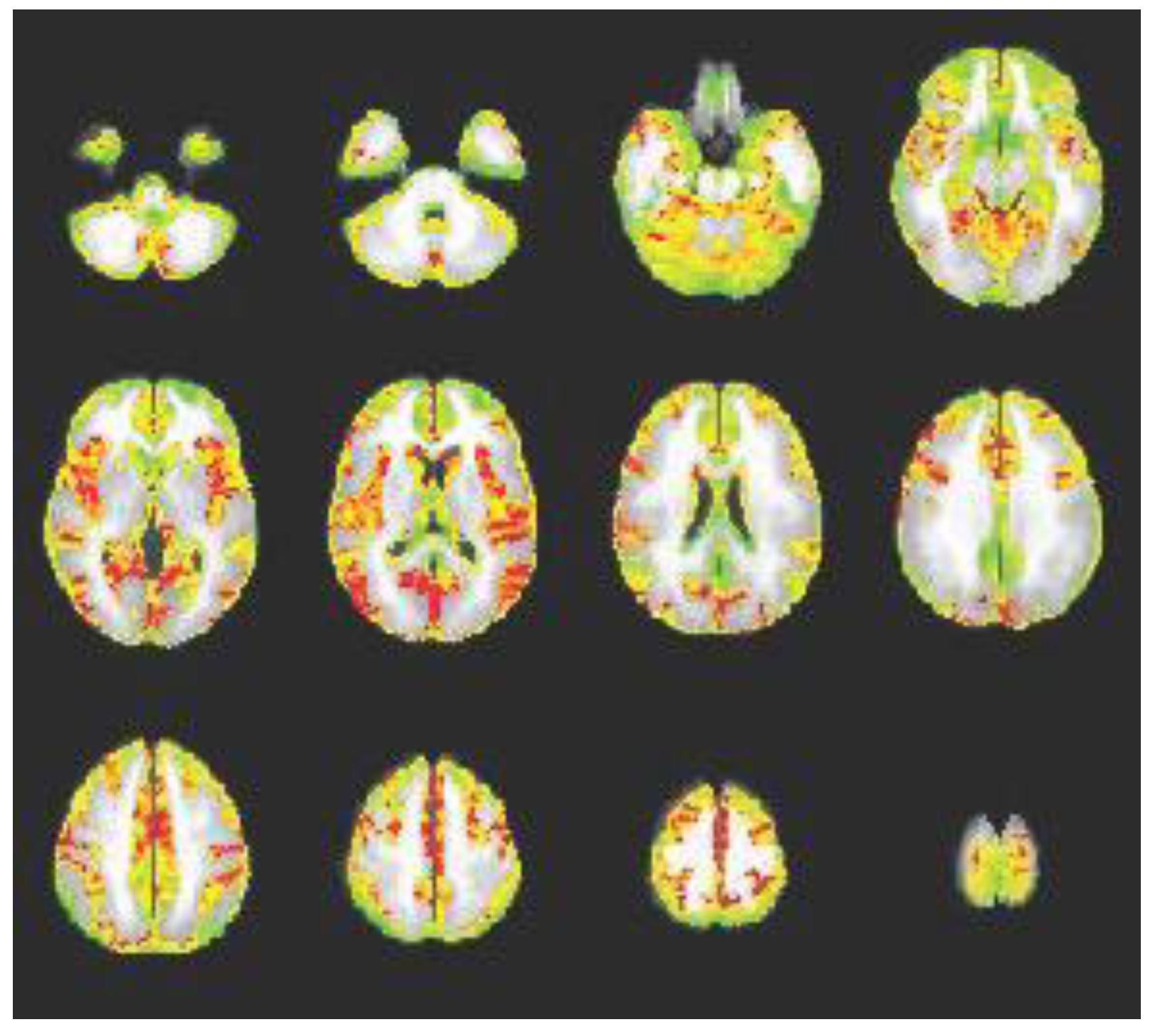 Brainsci 13 01413 g004