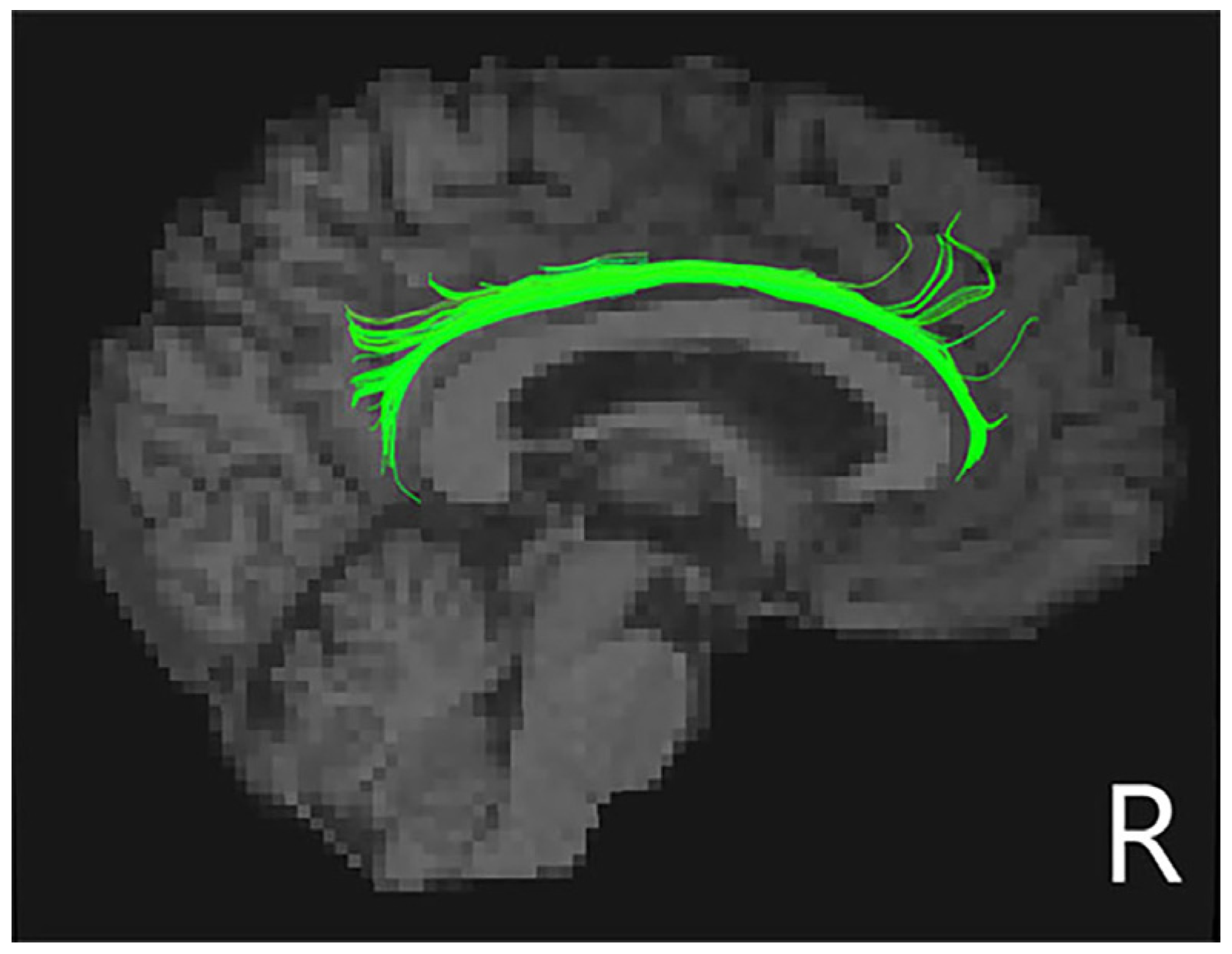 Brainsci 13 01423 g002