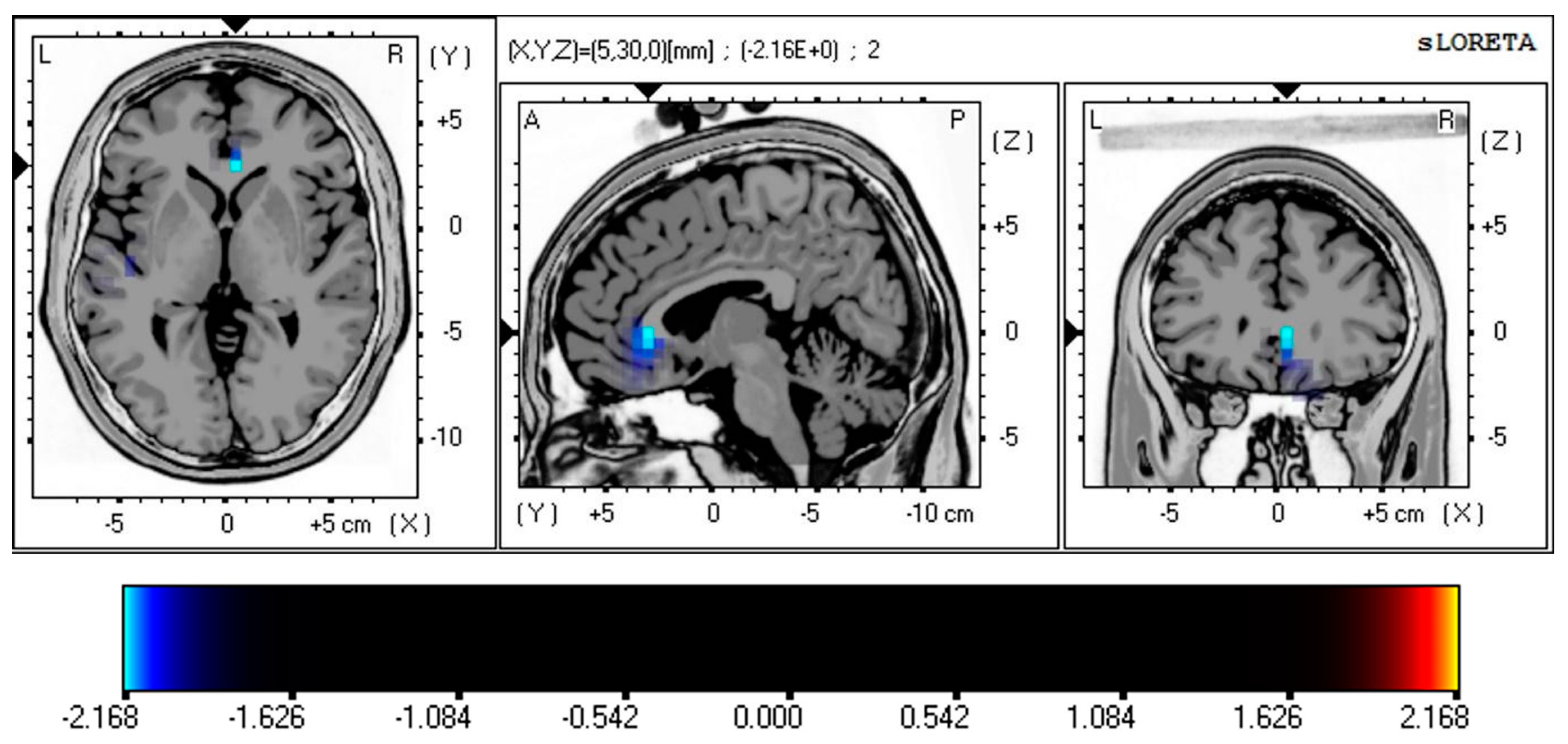 Brainsci 13 01440 g002