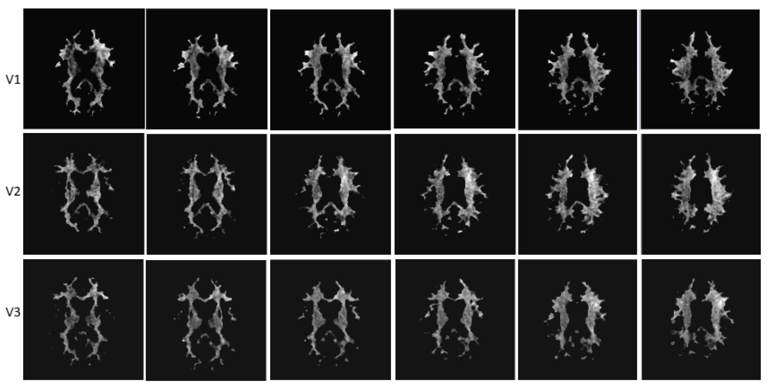 Brainsci 13 01464 g004