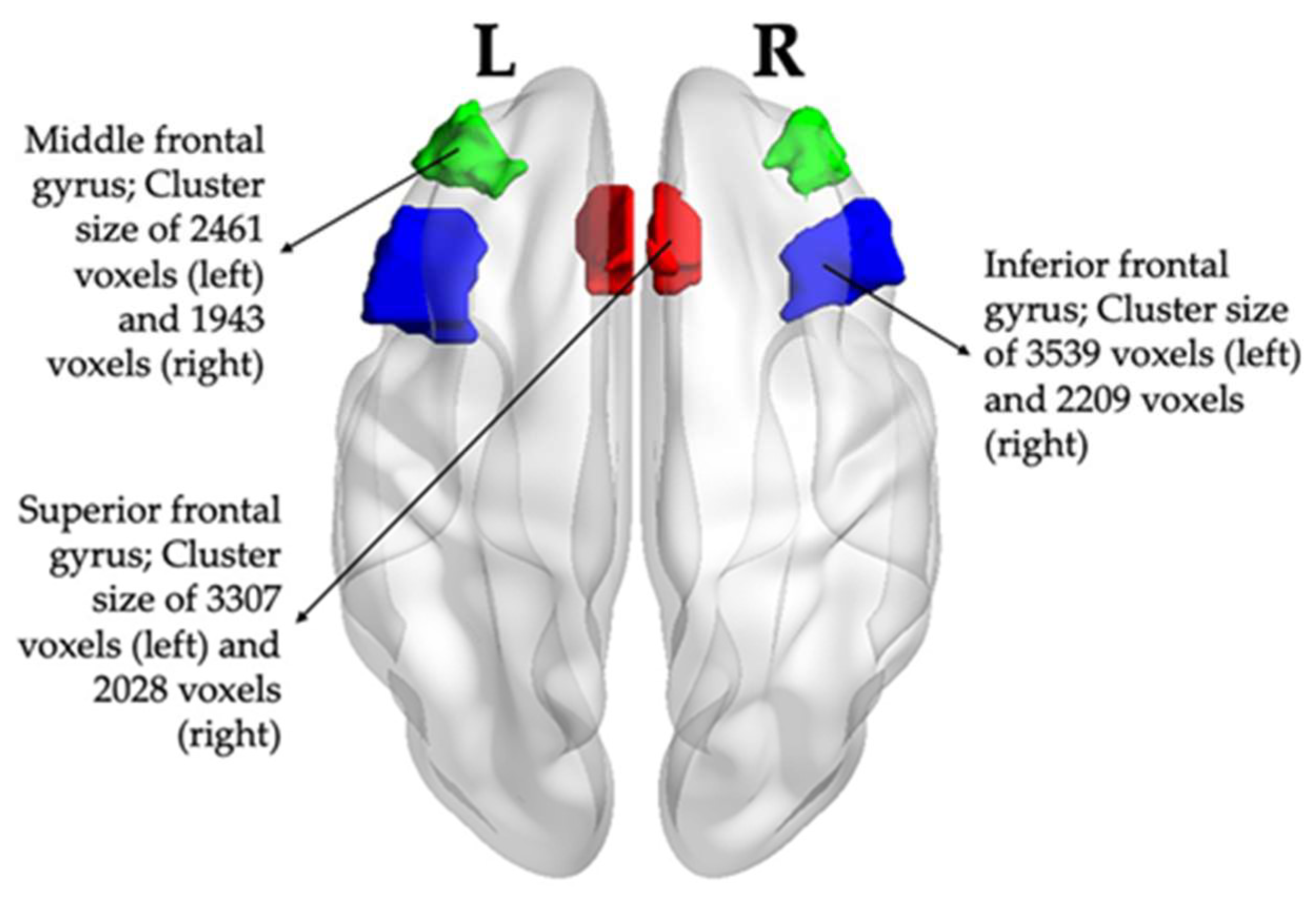 Brainsci 13 01469 g002