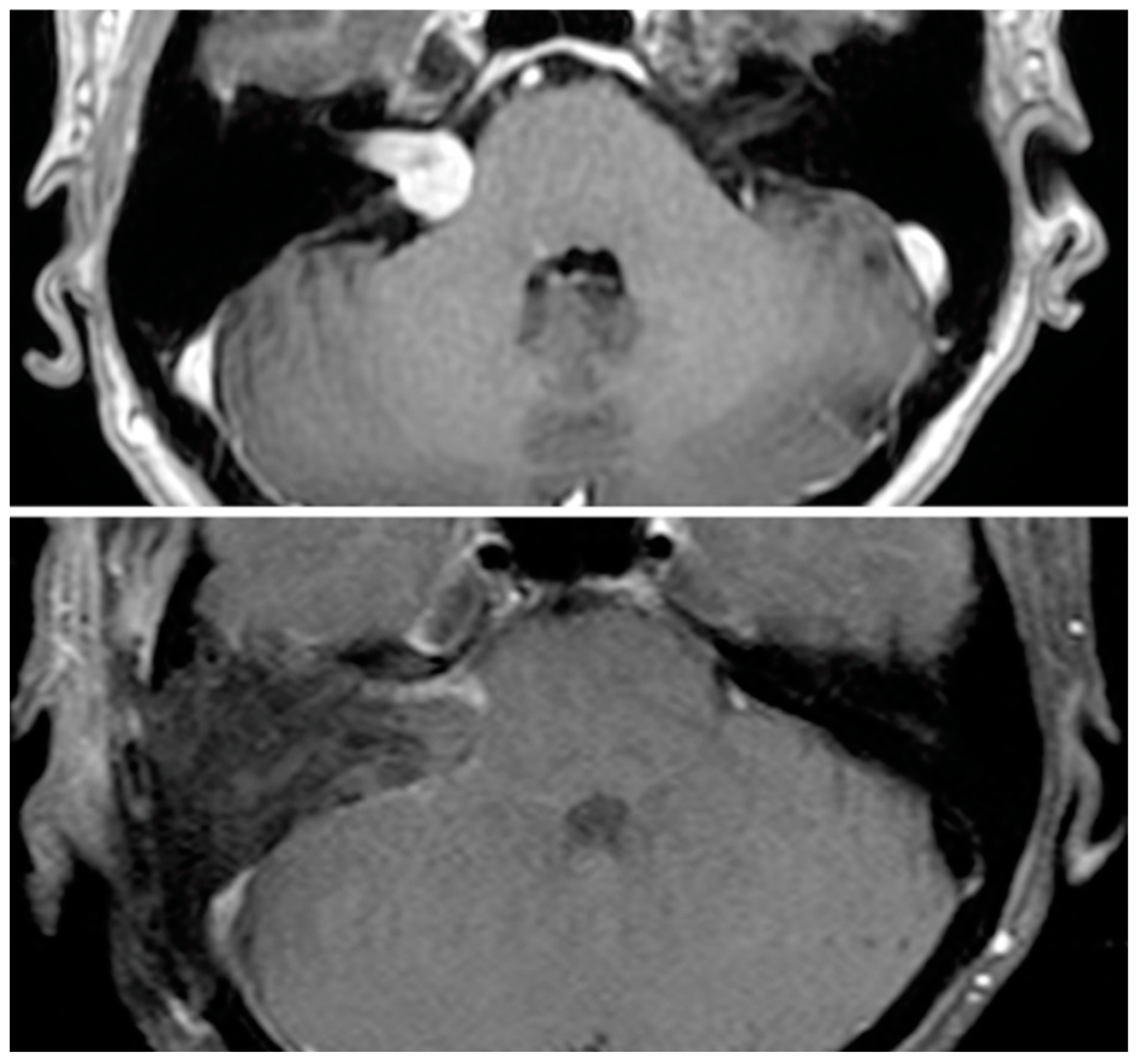Brainsci 13 01490 g001 Brainsci 13 01490 g001