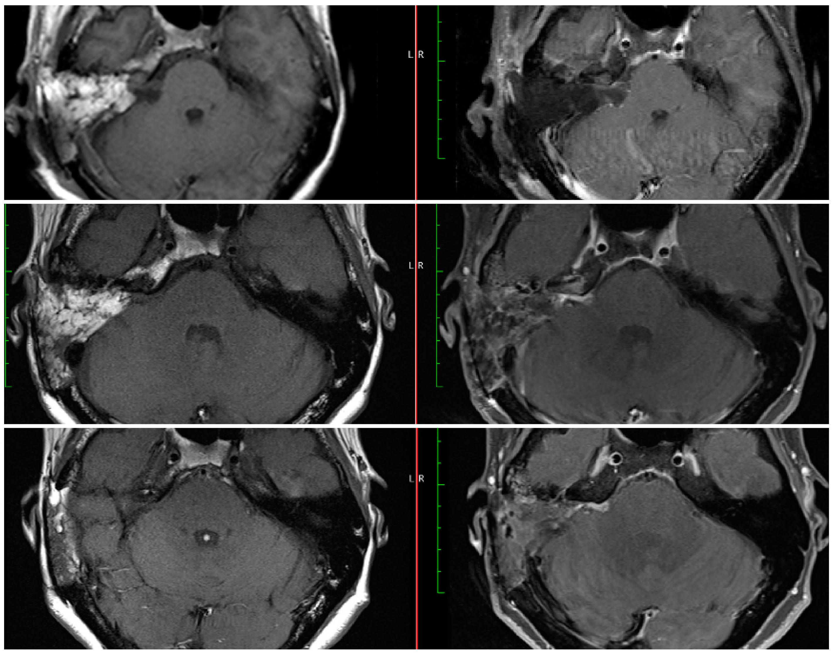 Brainsci 13 01490 g002 Brainsci 13 01490 g002