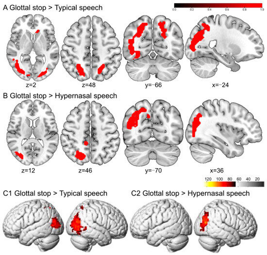 Brainsci 13 01506 g003